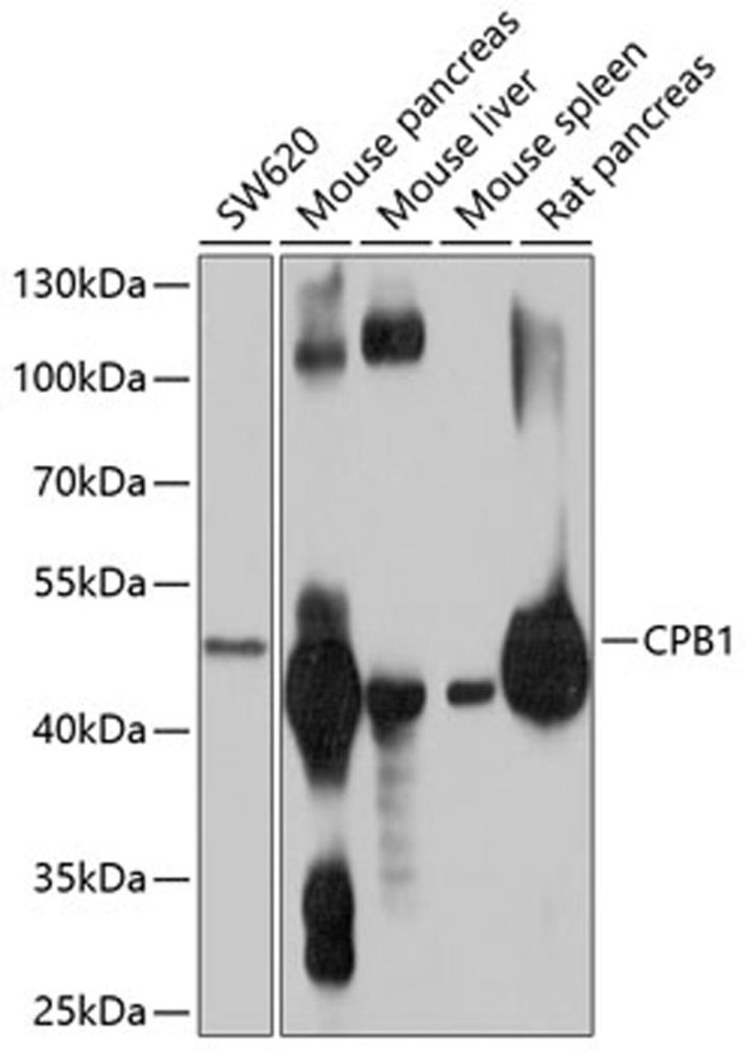 Western blot - CPB1 antibody (A10486)