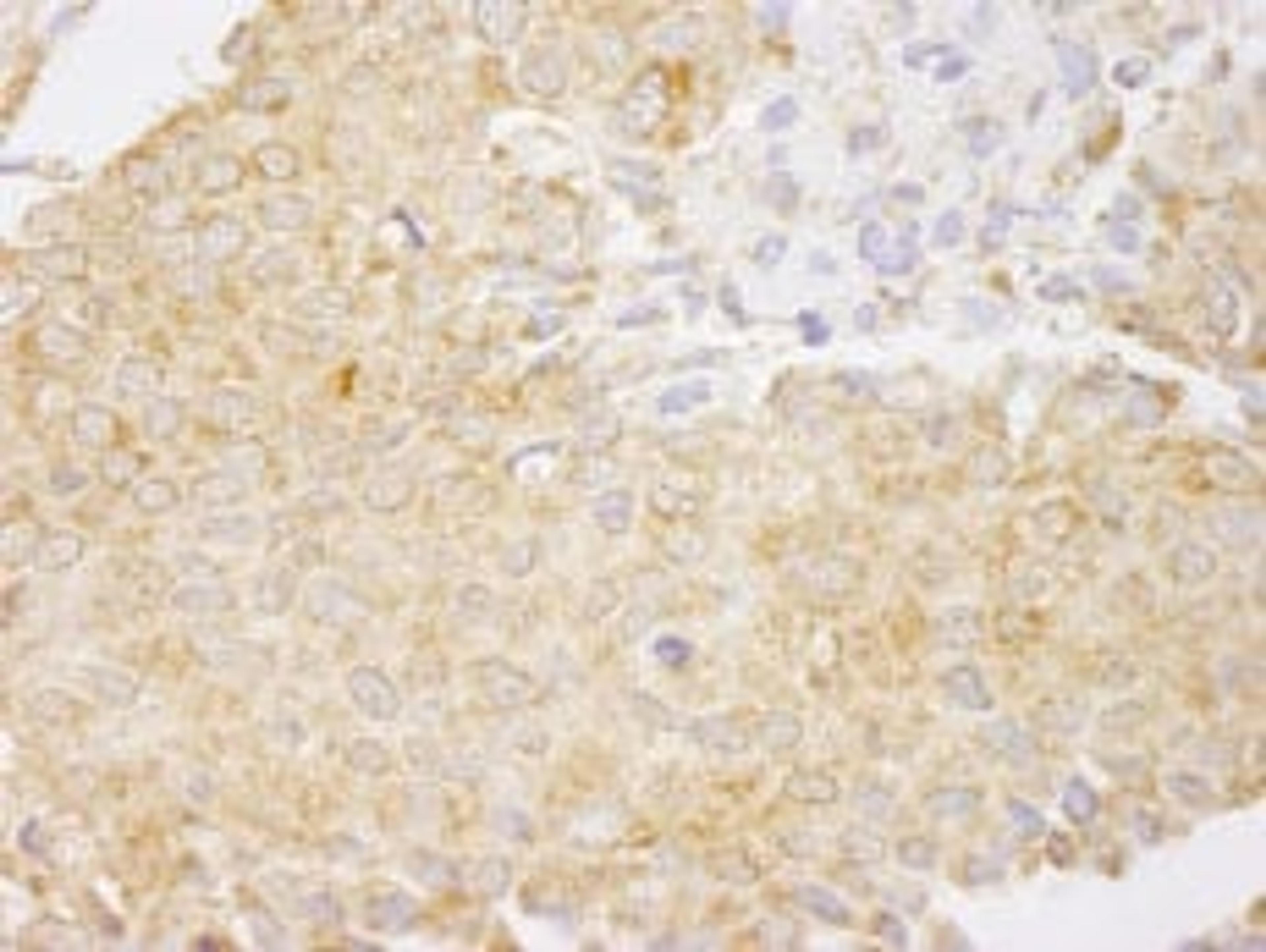 Detection of human NF-kappaB1 immunohistochemistry.