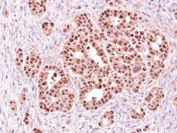 Immunohistochemistry-Paraffin: ALOXE3 Antibody [NBP1-32533] - Paraffin-embedded NCI-N87 xenograft, using antibody at 1:500 dilution.