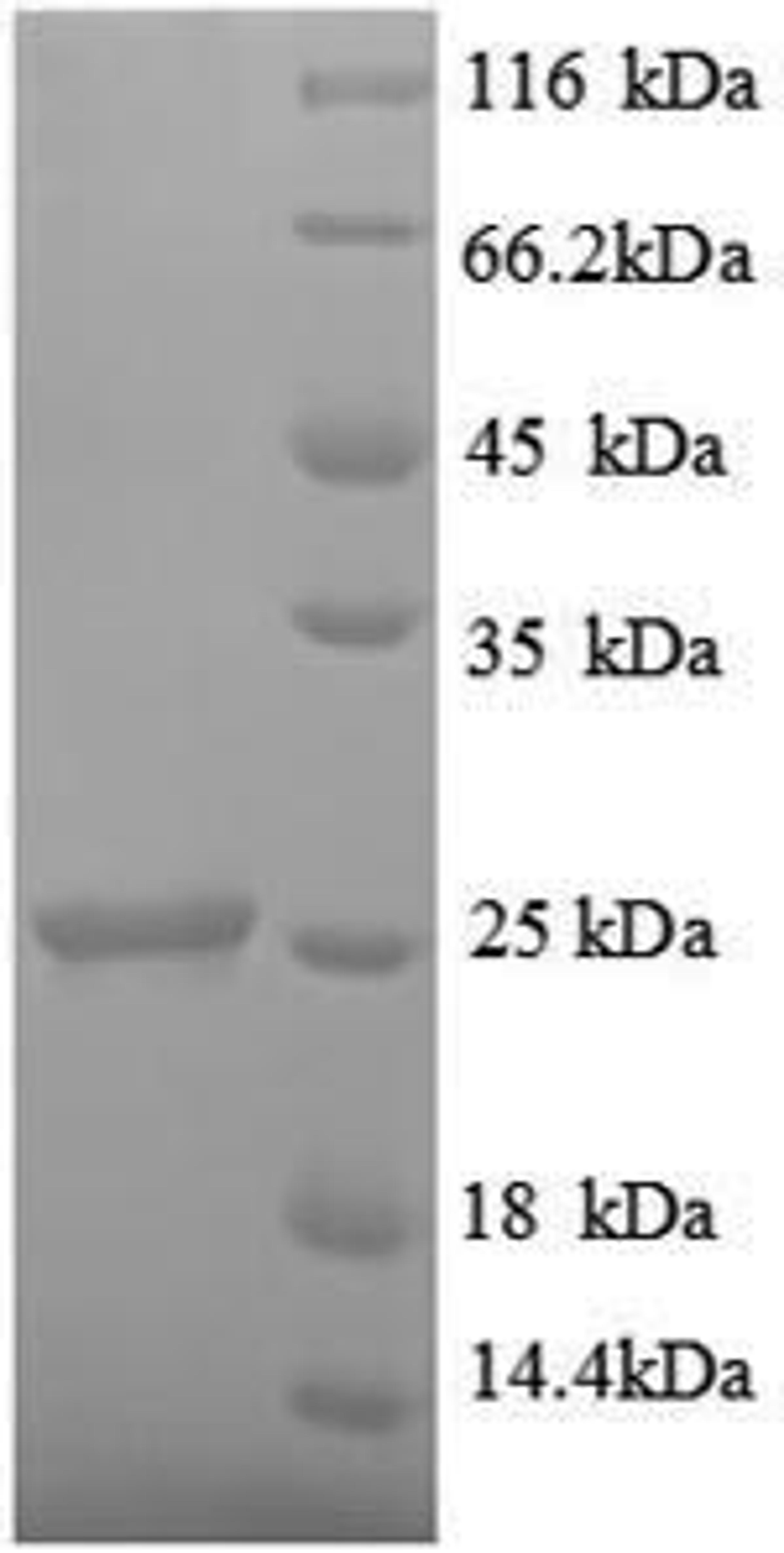 (Tris-Glycine gel) Discontinuous SDS-PAGE (reduced) with 5% enrichment gel and 15% separation gel.