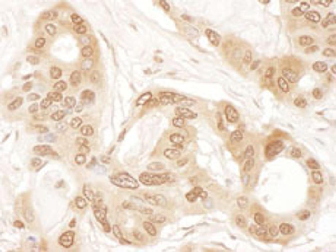 Detection of human ICLN by immunohistochemistry.