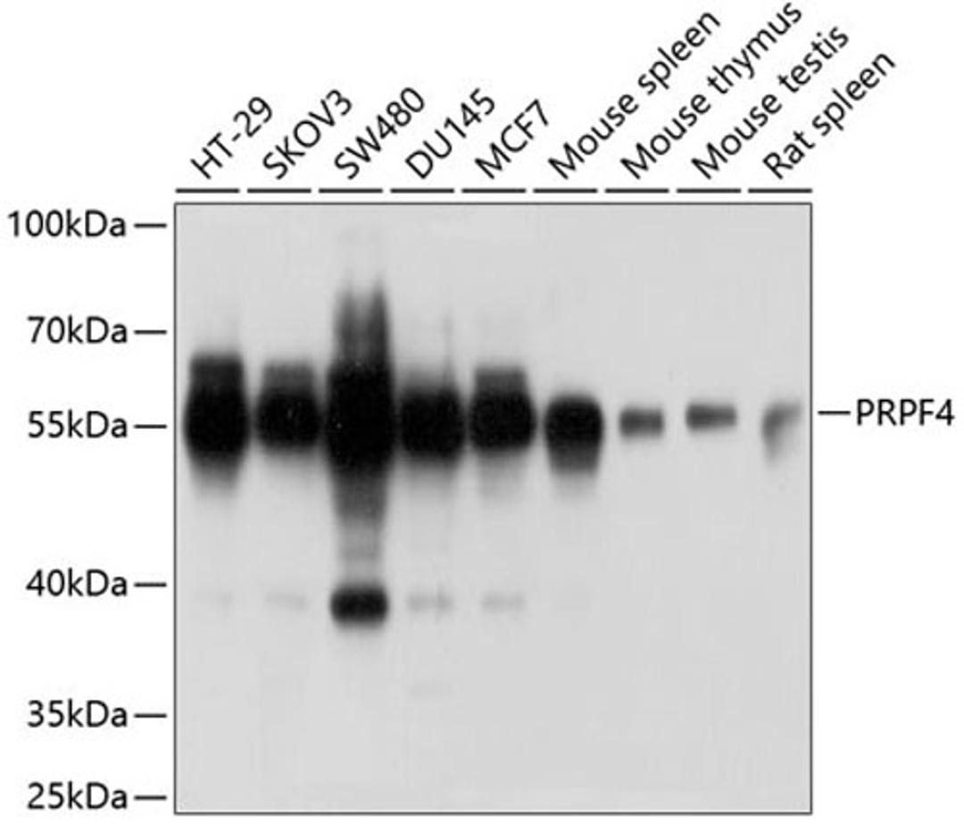 Western blot - PRPF4 antibody (A6052)