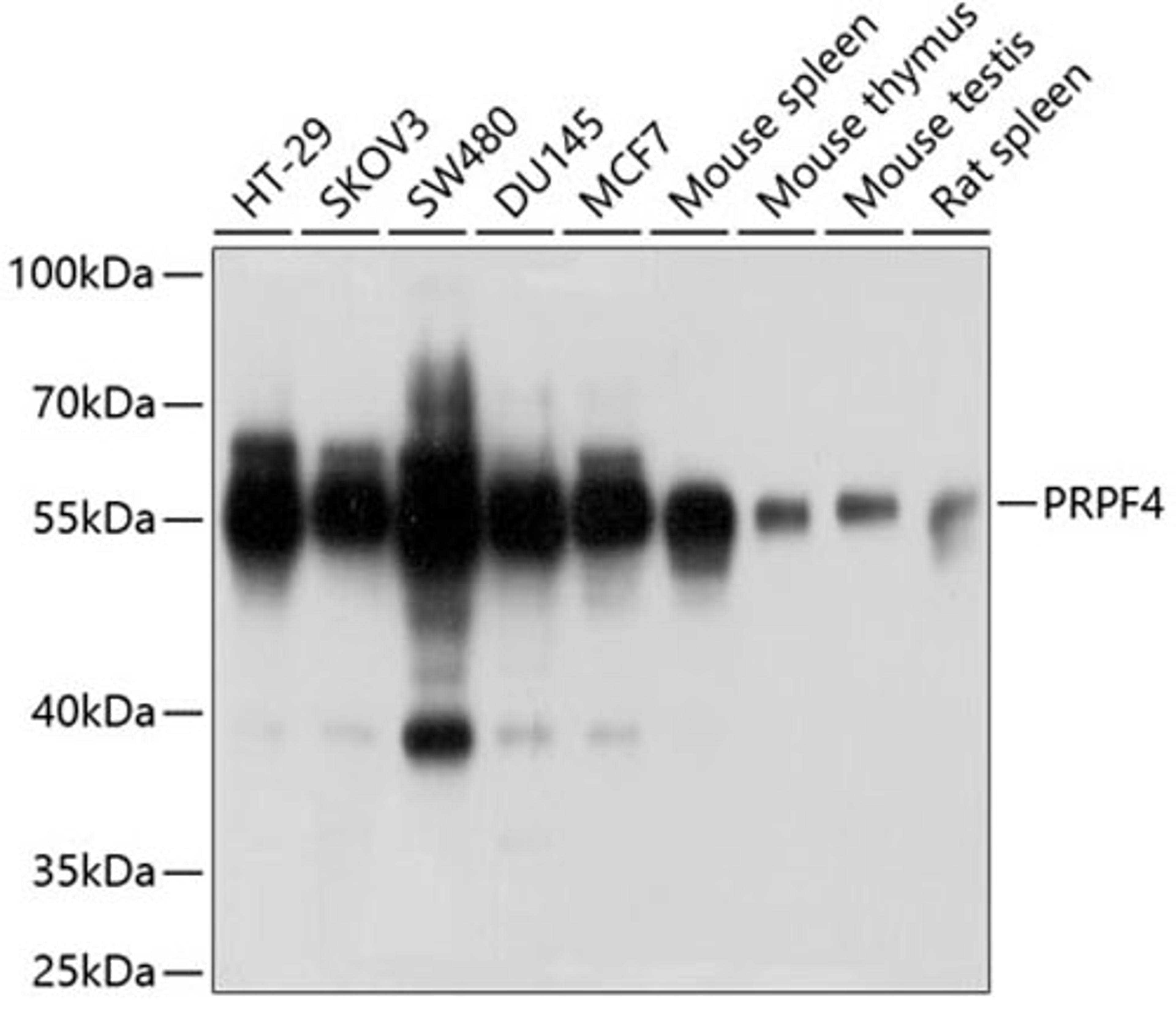 Western blot - PRPF4 antibody (A6052)