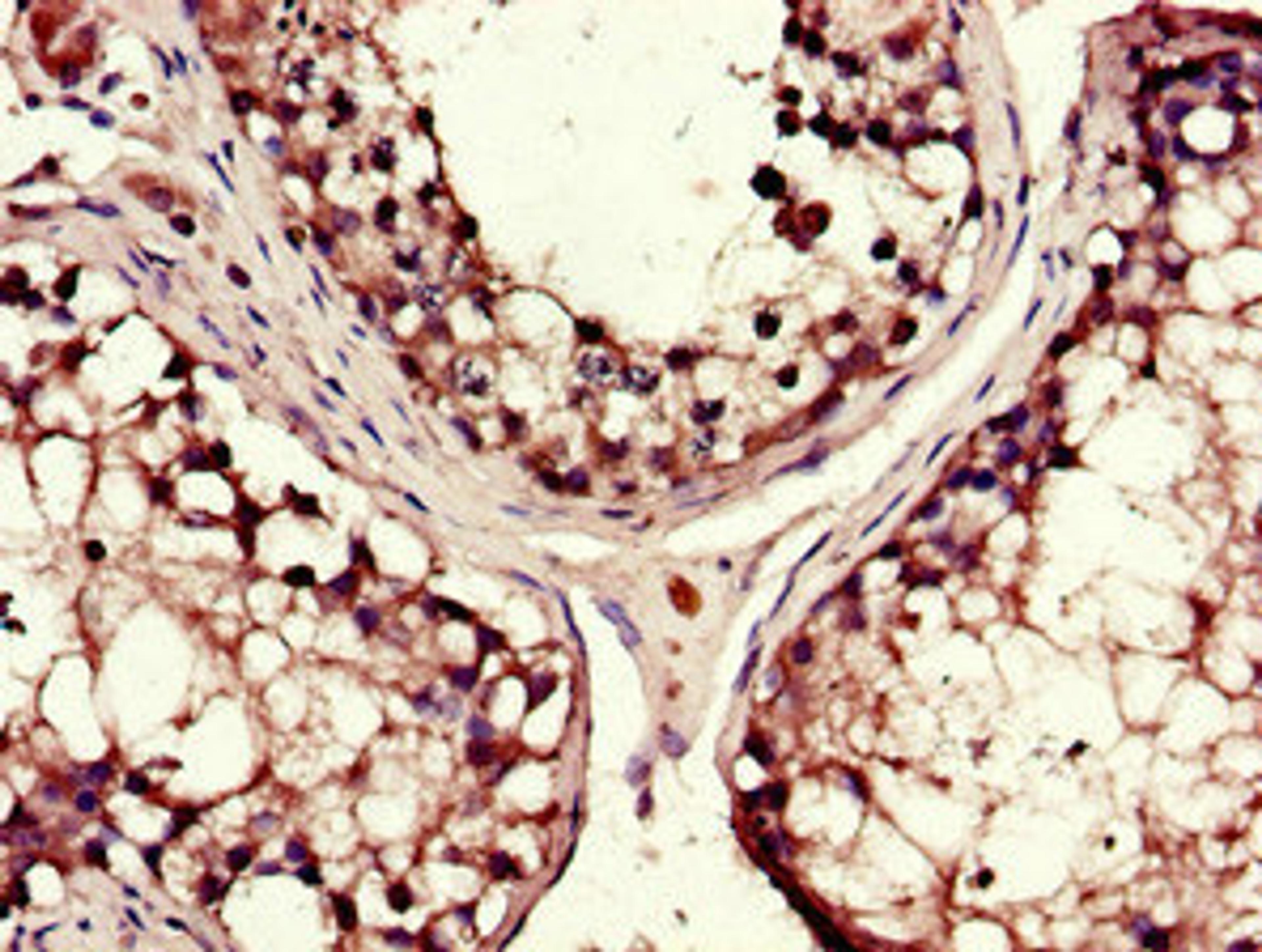 Immunohistochemistry of paraffin-embedded human testis tissue using CSB-PA613491LA01HU at dilution of 1:100