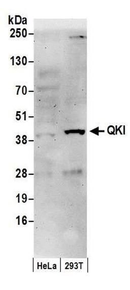 Detection of human QKI by WB.