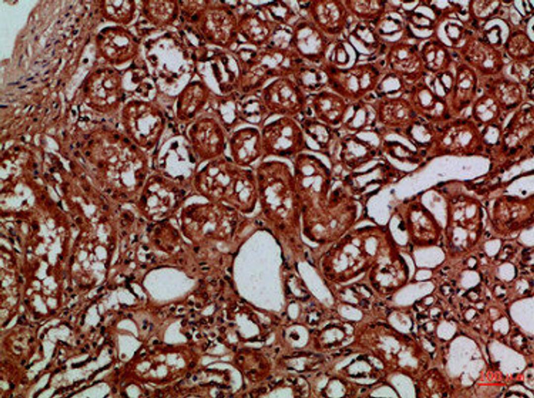 Immunohistochemical analysis of paraffin-embedded Human-kidney, antibody was diluted at 1:100