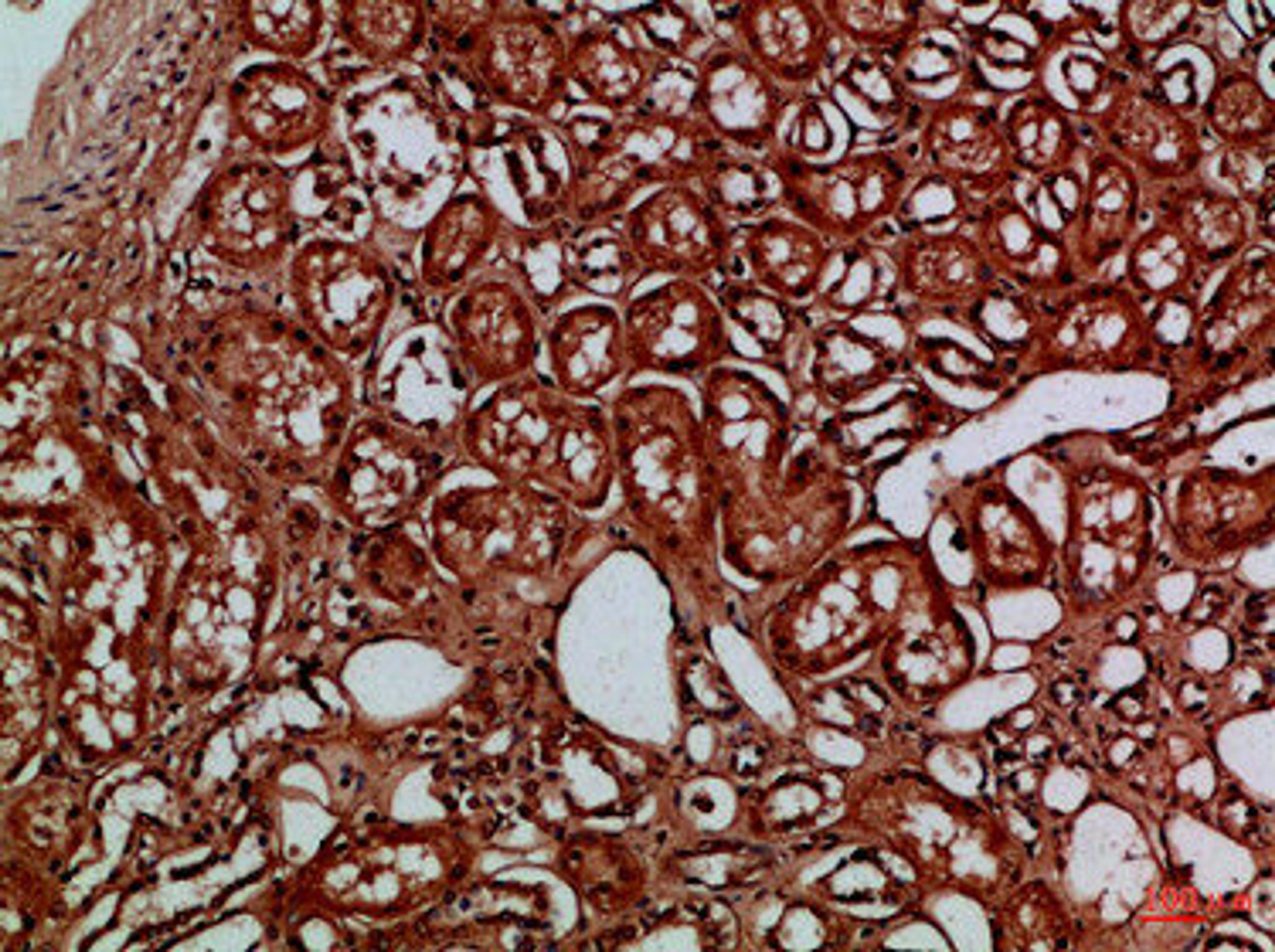Immunohistochemical analysis of paraffin-embedded Human-kidney, antibody was diluted at 1:100