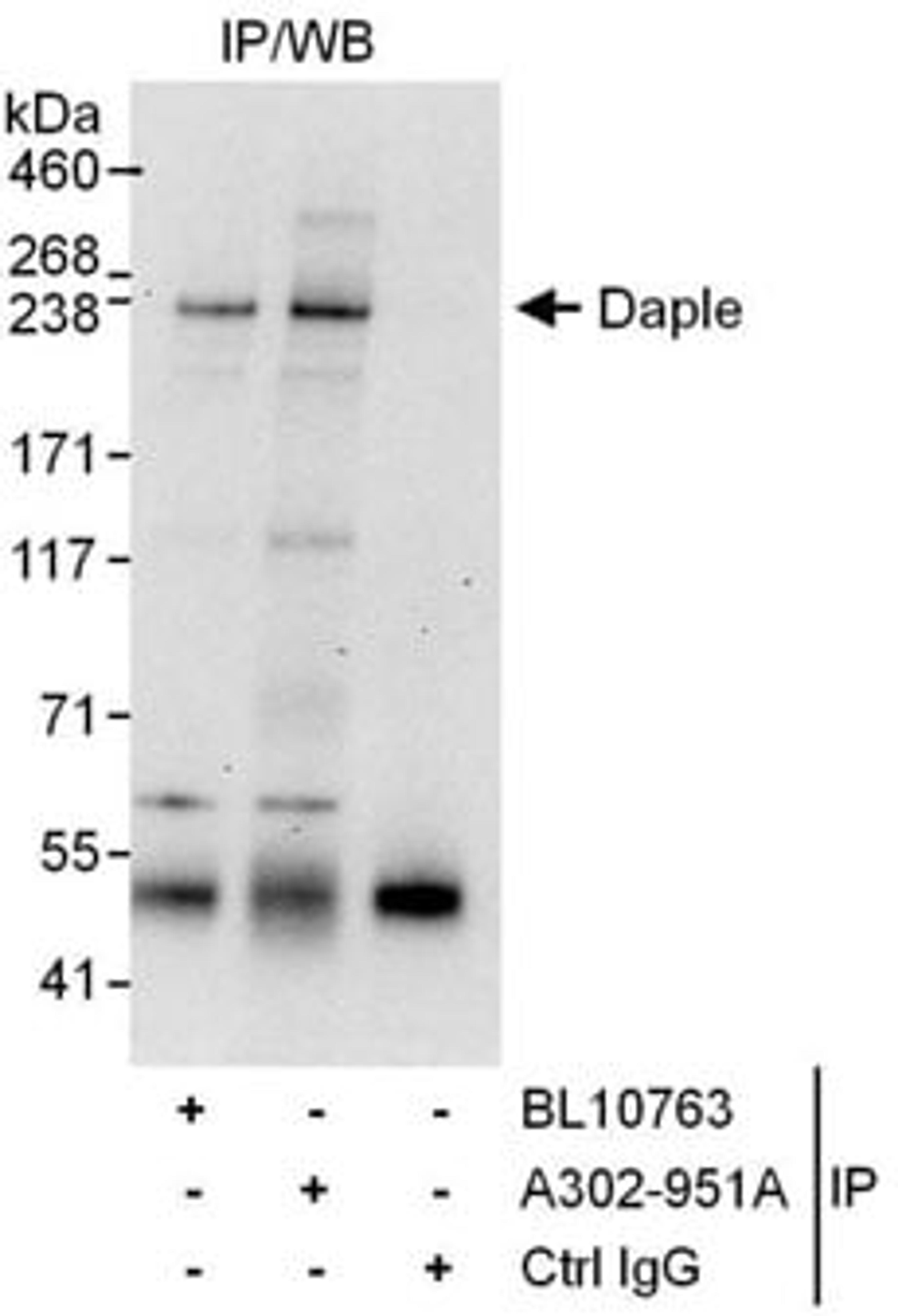 Detection of human Daple by western blot of immunoprecipitates.