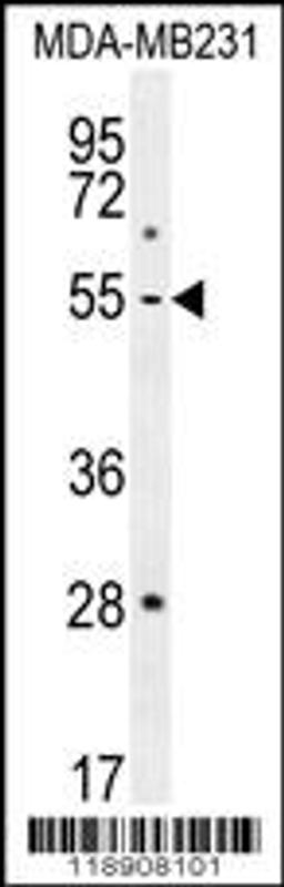 Western blot analysis in MDA-MB231 cell line lysates (35ug/lane).