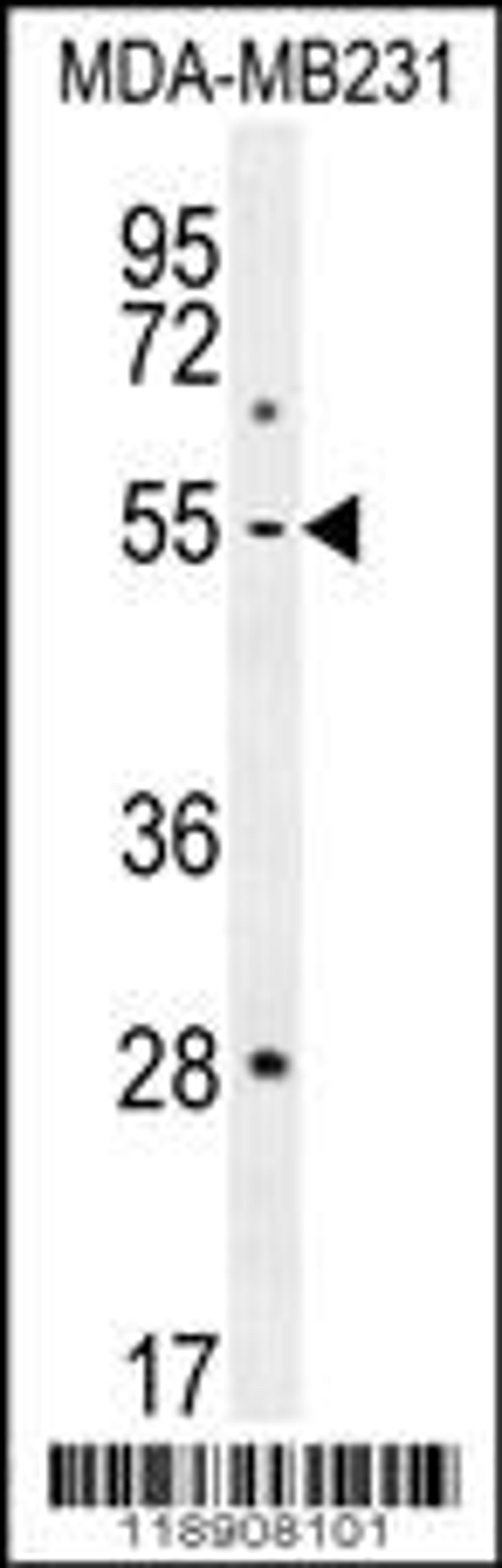 Western blot analysis in MDA-MB231 cell line lysates (35ug/lane).