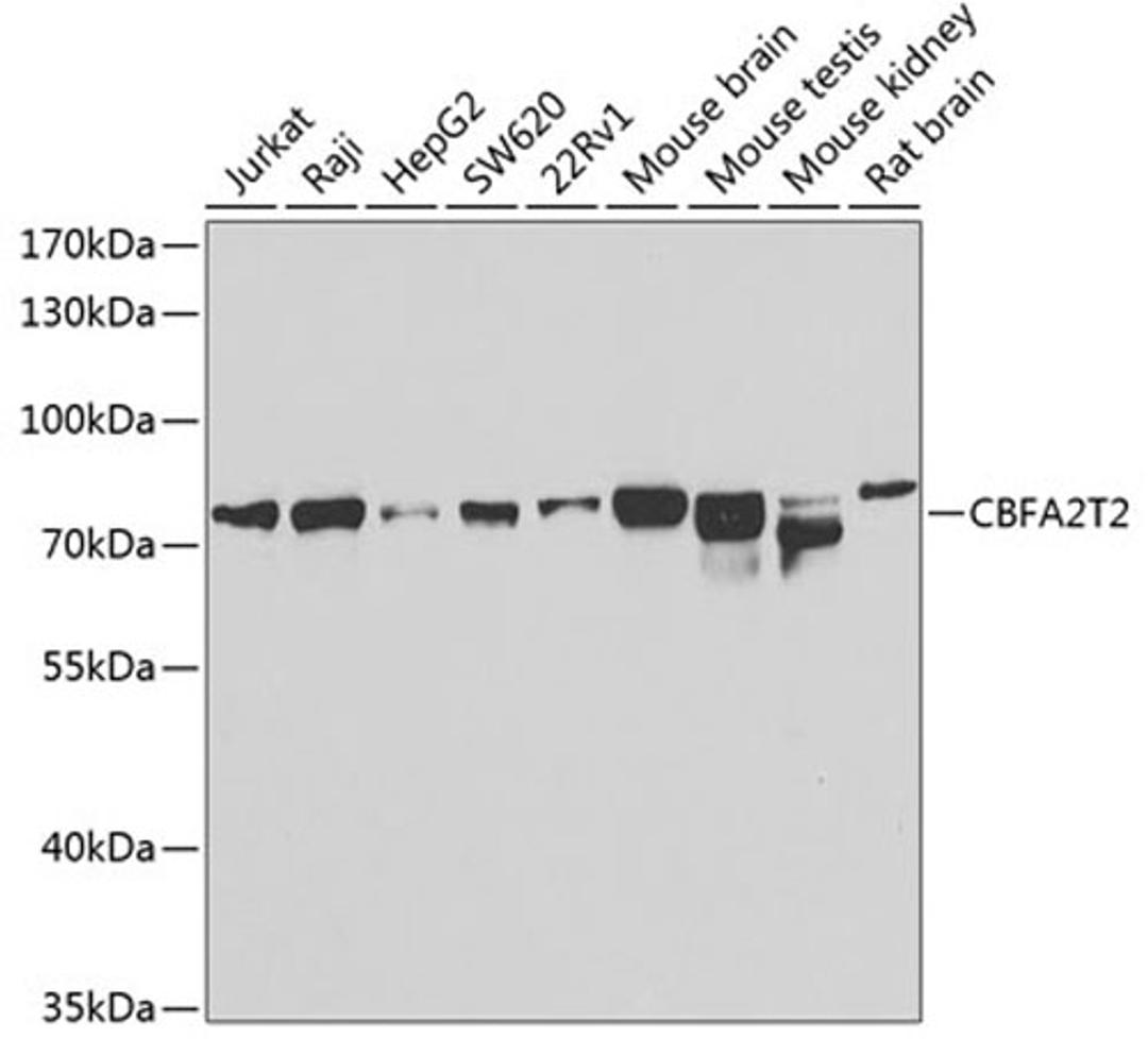 Western blot - CBFA2T2 antibody (A7033)