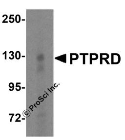 Western blot analysis of PTPRD in HeLa cell lysate with PTPRD antibody at 1 μg/mL.