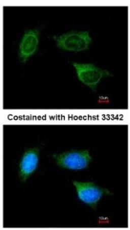 Immunocytochemistry/Immunofluorescence: ATP5F1 Antibody [NBP1-33465] - Analysis of methanol-fixed HeLa, using antibody at 1:200 dilution.