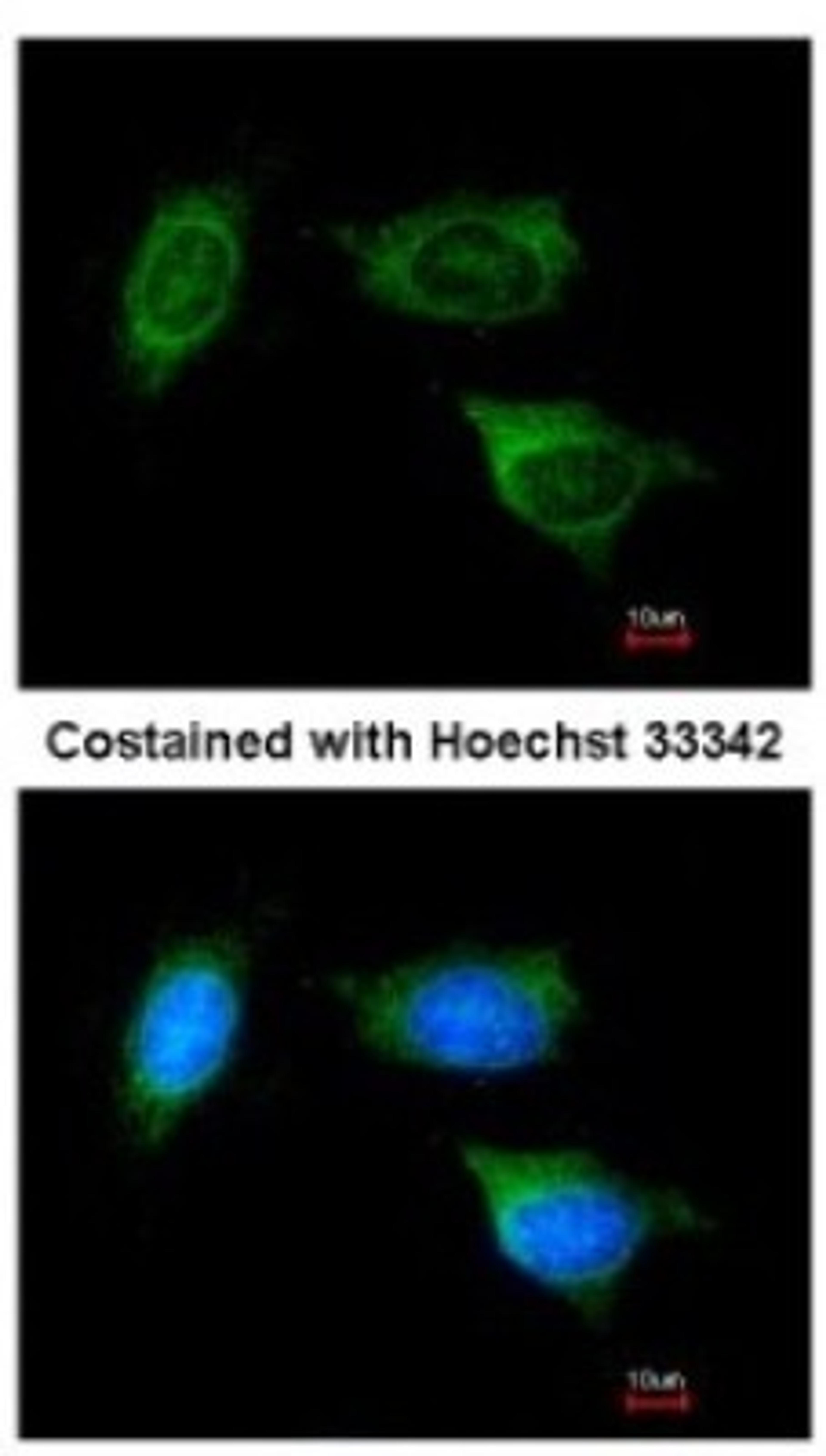 Immunocytochemistry/Immunofluorescence: ATP5F1 Antibody [NBP1-33465] - Analysis of methanol-fixed HeLa, using antibody at 1:200 dilution.