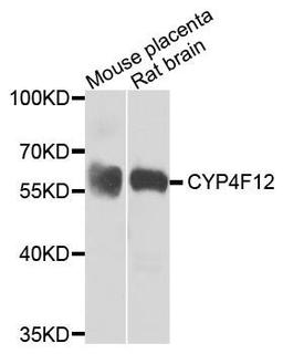 Western blot analysis of extracts of mouse placenta and rat brain using CYP4F12 antibody