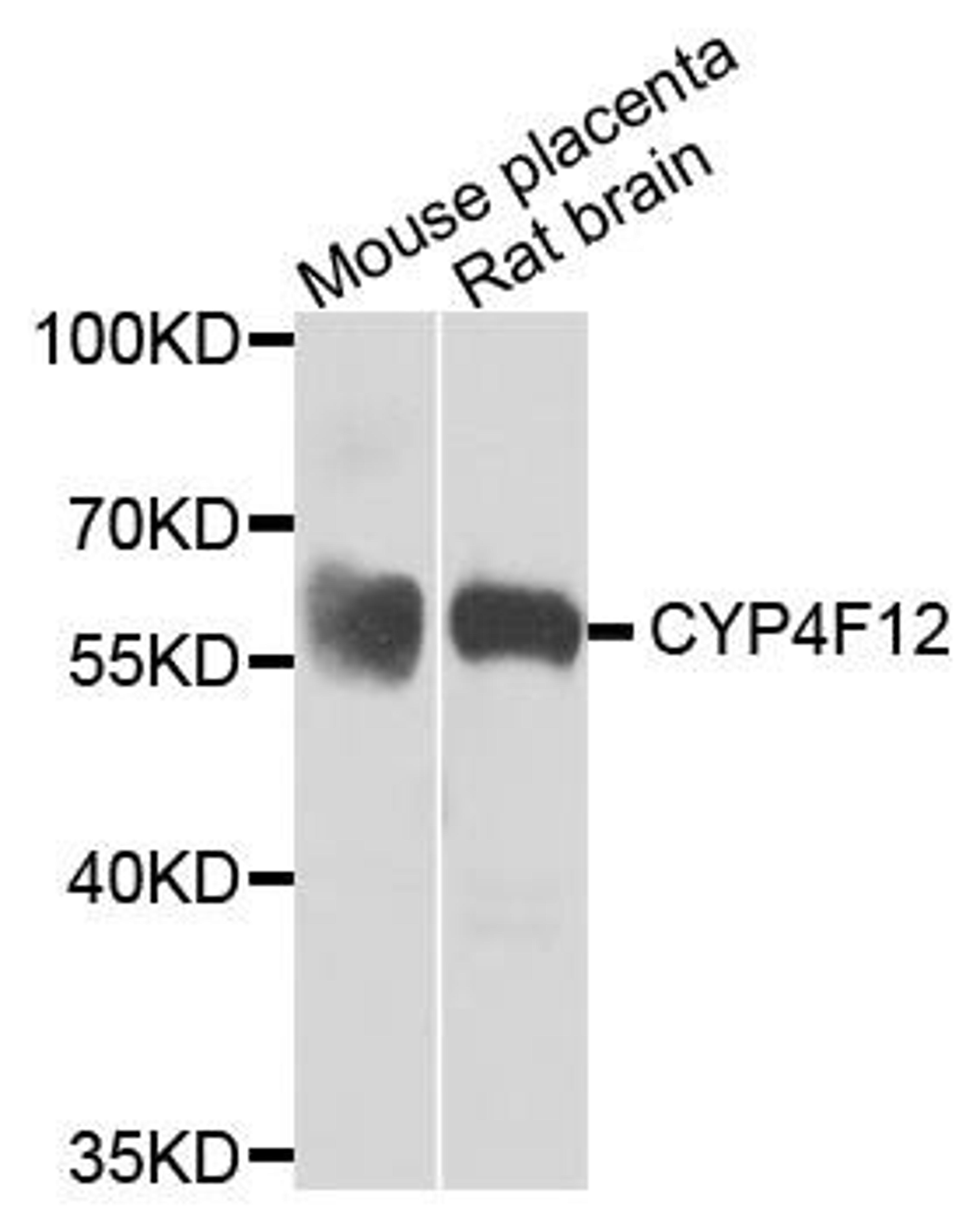 Western blot analysis of extracts of mouse placenta and rat brain using CYP4F12 antibody