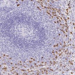 Immunohistochemistry: OR51A7 Antibody [NBP2-32348] - Staining of human spleen shows strong cytoplasmic positivity in cells in red pulp.