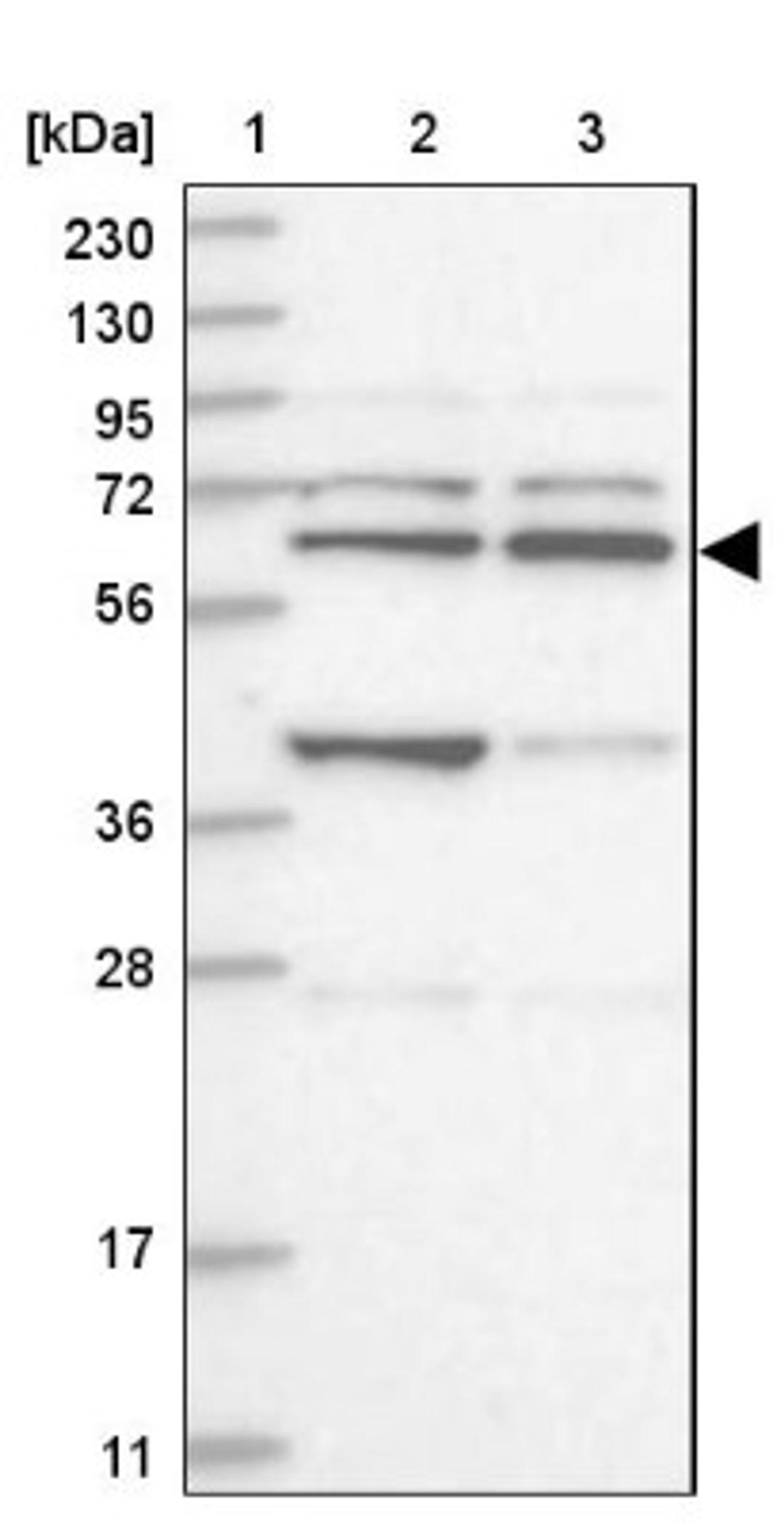 Western Blot: ZNF500 Antibody [NBP1-81502] - Lane 1: Marker [kDa] 230, 130, 95, 72, 56, 36, 28, 17, 11<br/>Lane 2: Human cell line RT-4<br/>Lane 3: Human cell line U-251MG sp