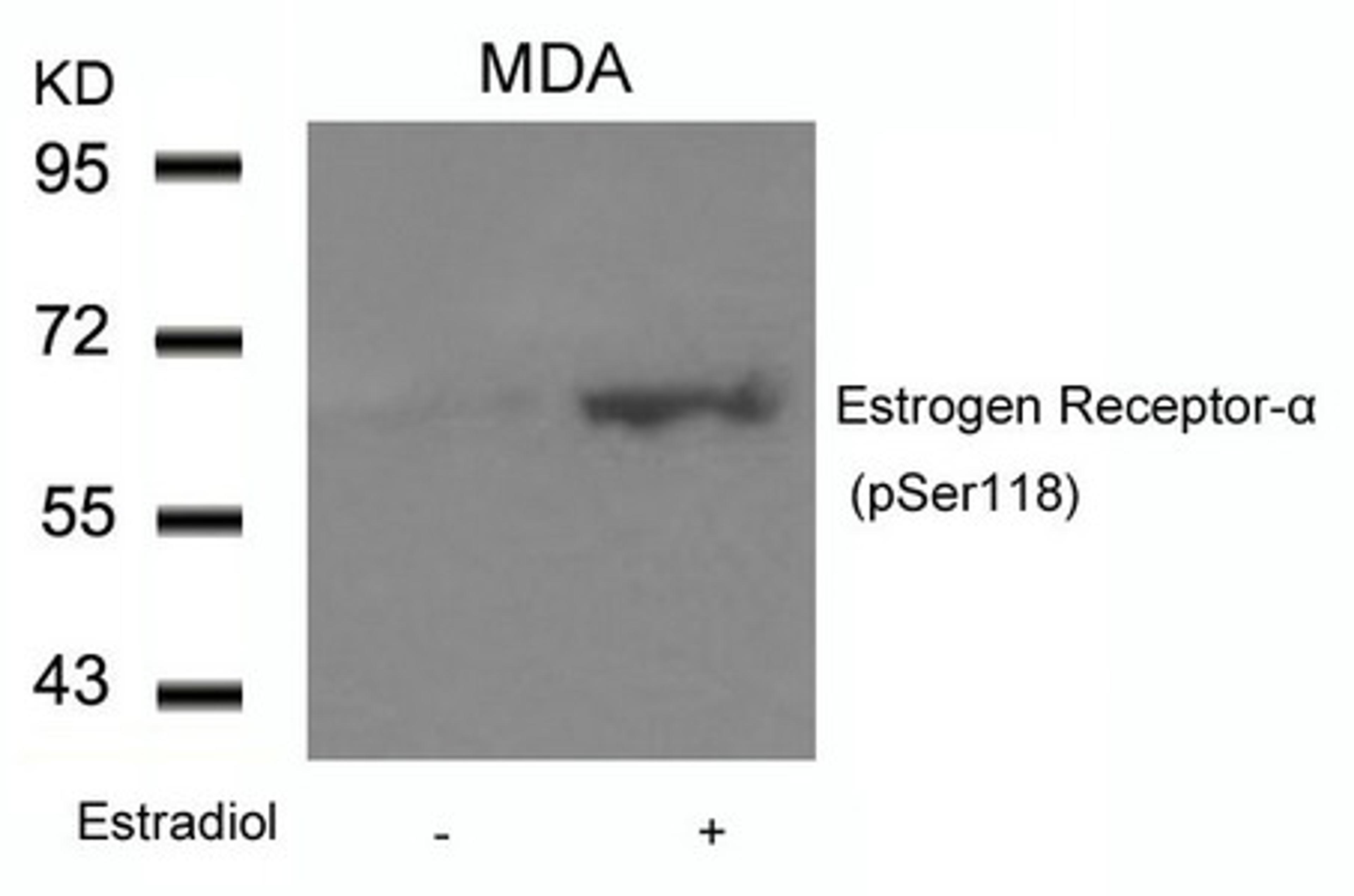 Western blot analysis of extracts from MDA cells untreated or treated with Estradiol using Estrogen Receptor-a(Phospho-Ser118) Antibody.