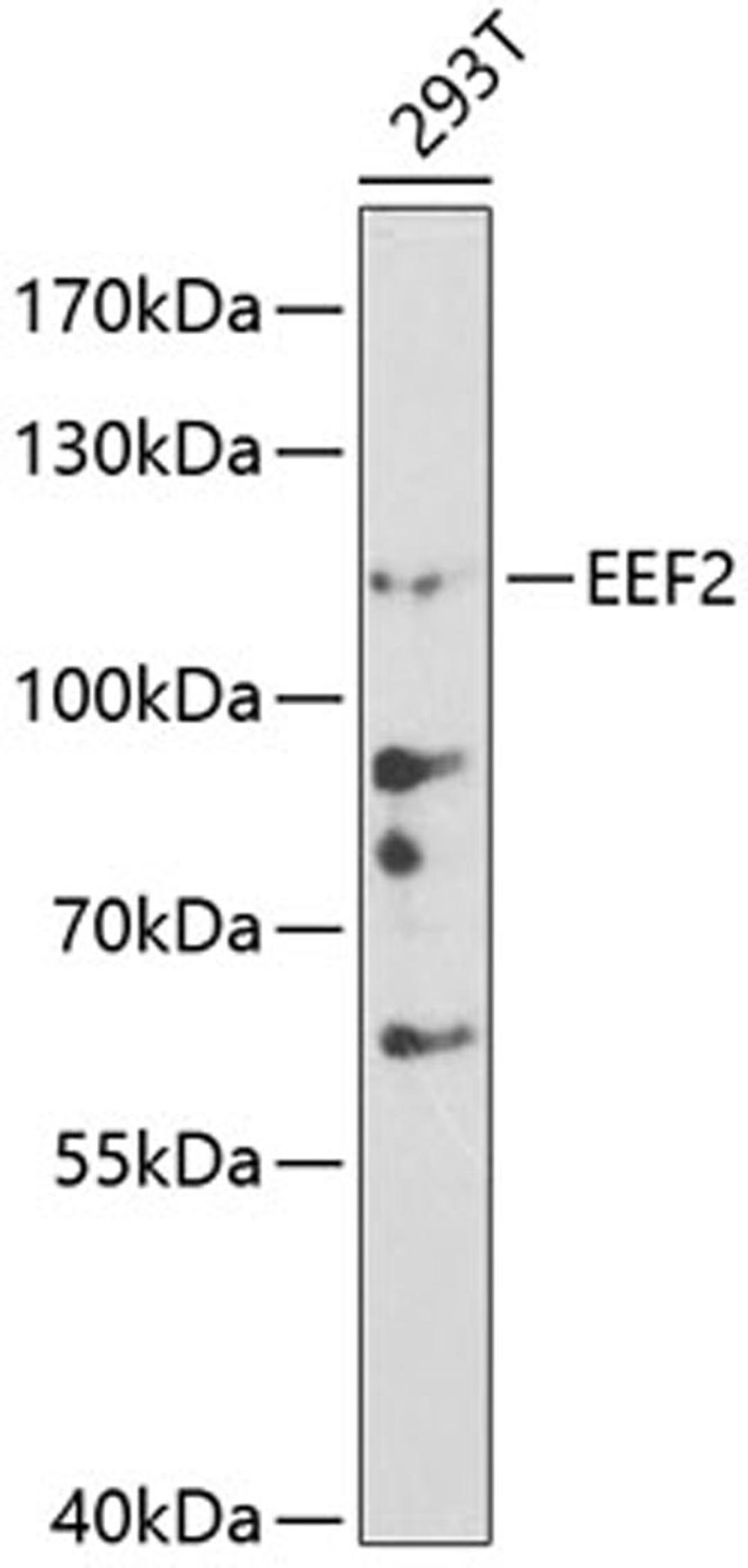 Western blot - EEF2 antibody (A0099)