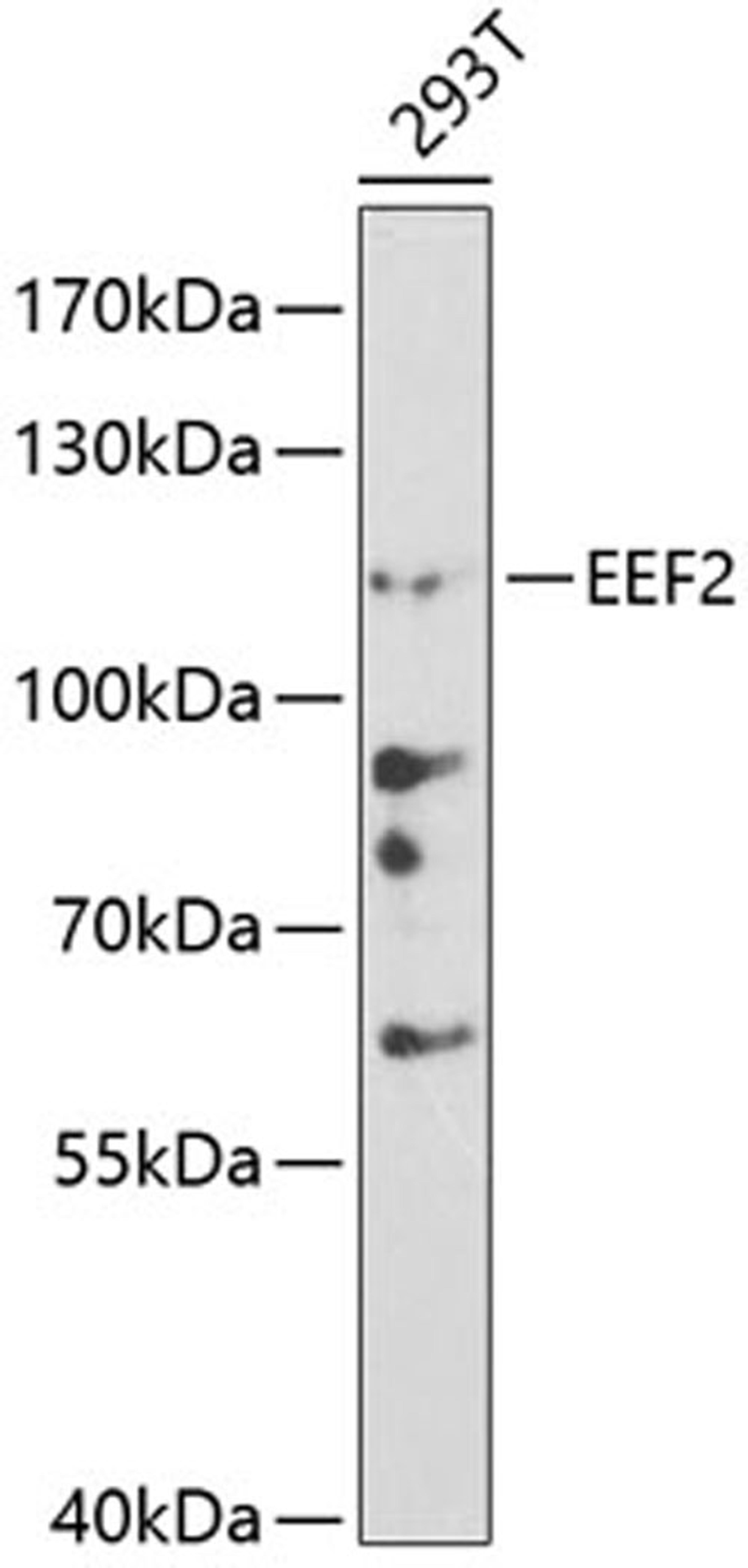 Western blot - EEF2 antibody (A0099)