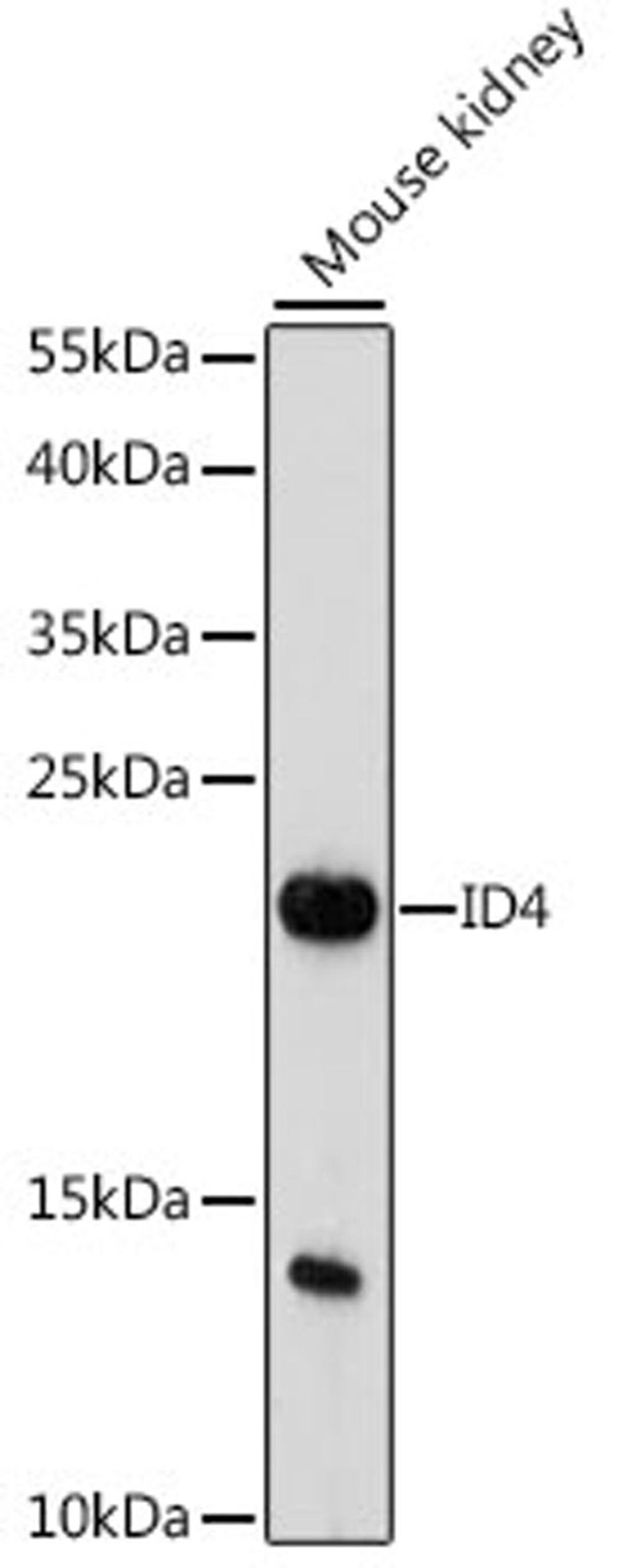 Western blot - ID4 antibody (A16229)