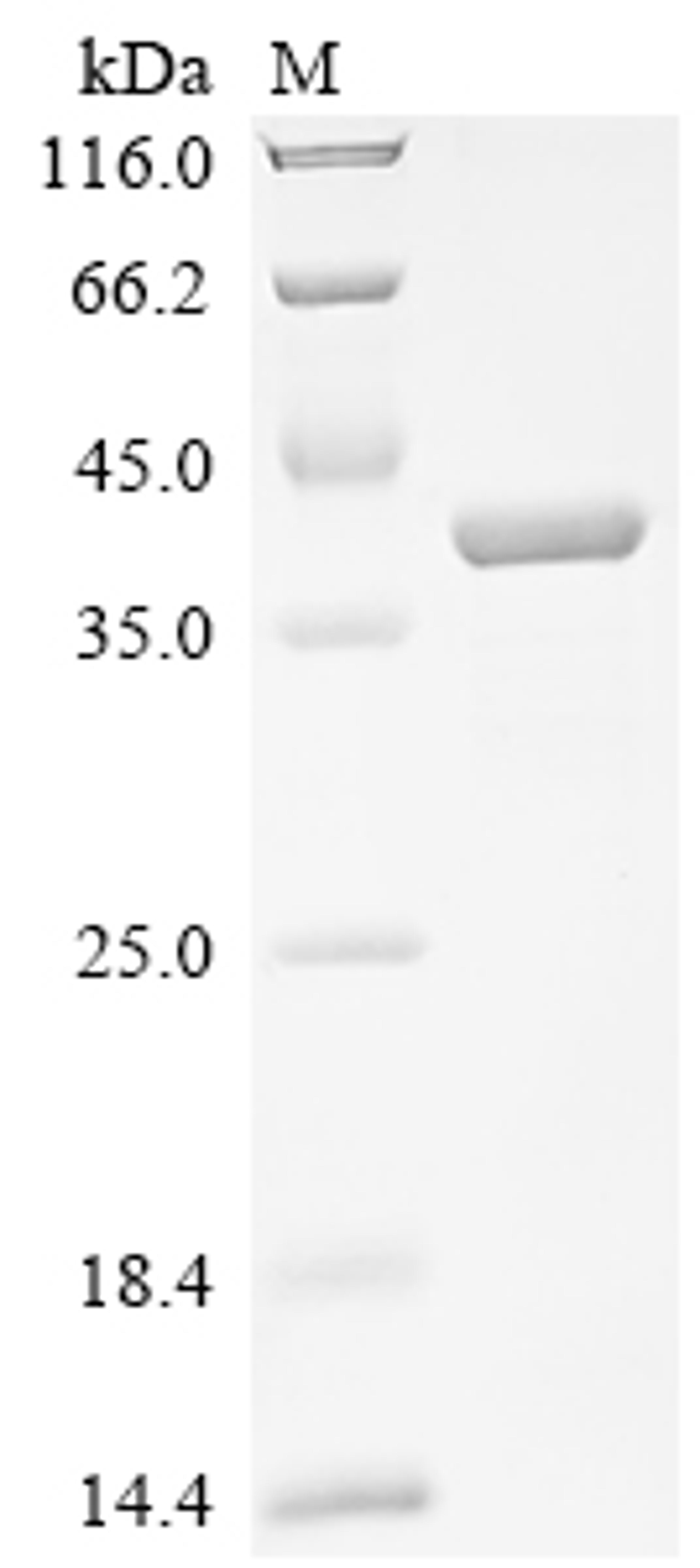 (Tris-Glycine gel) Discontinuous SDS-PAGE (reduced) with 5% enrichment gel and 15% separation gel.