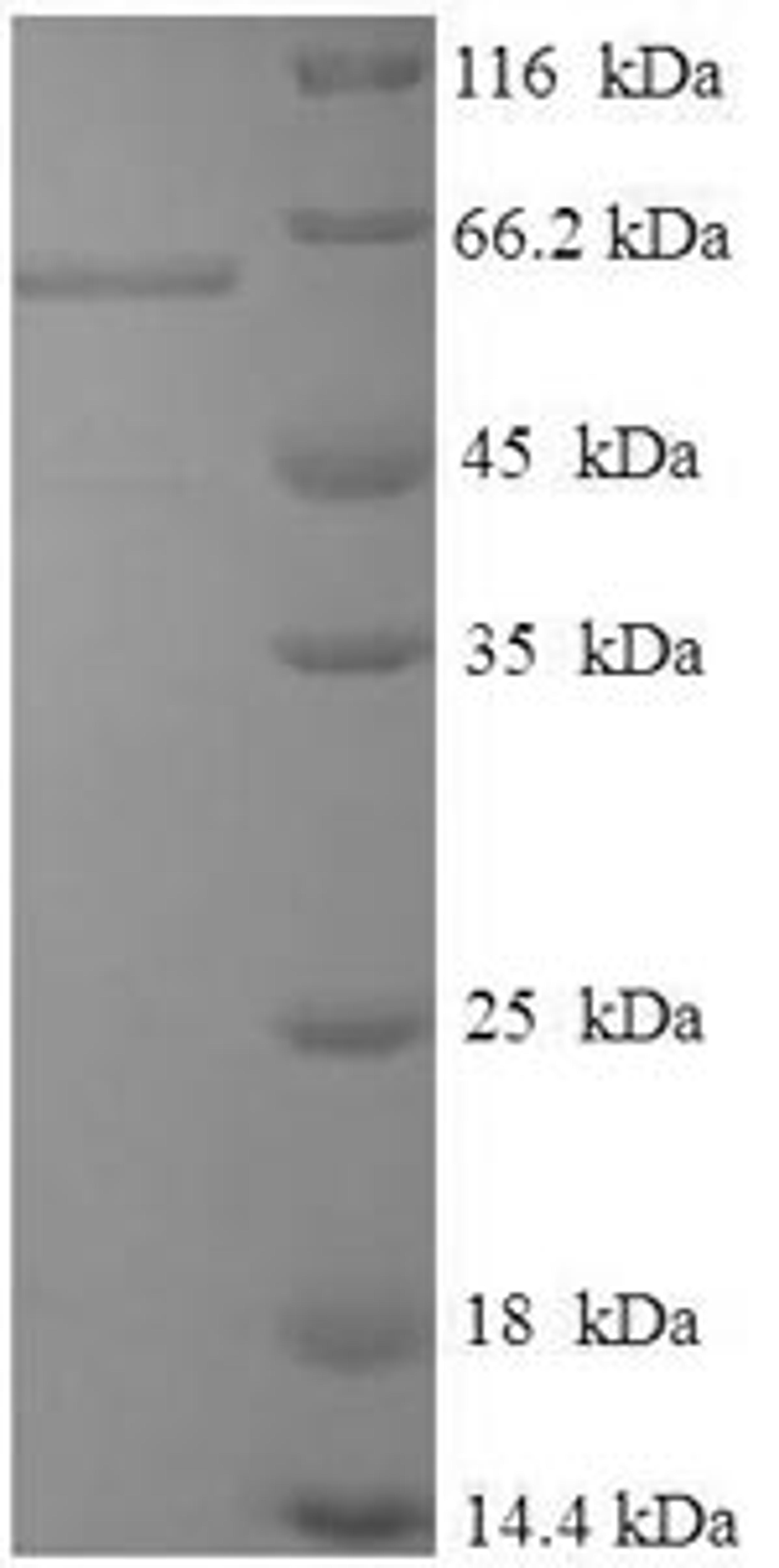 (Tris-Glycine gel) Discontinuous SDS-PAGE (reduced) with 5% enrichment gel and 15% separation gel.