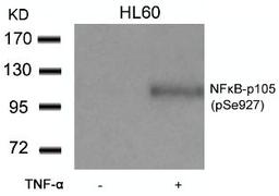 Western blot analysis of lysed extracts from HL60 cells untreated or treated with TNF-&#945; using NF&#954;B-p105/p50 (Phospho-Ser927).