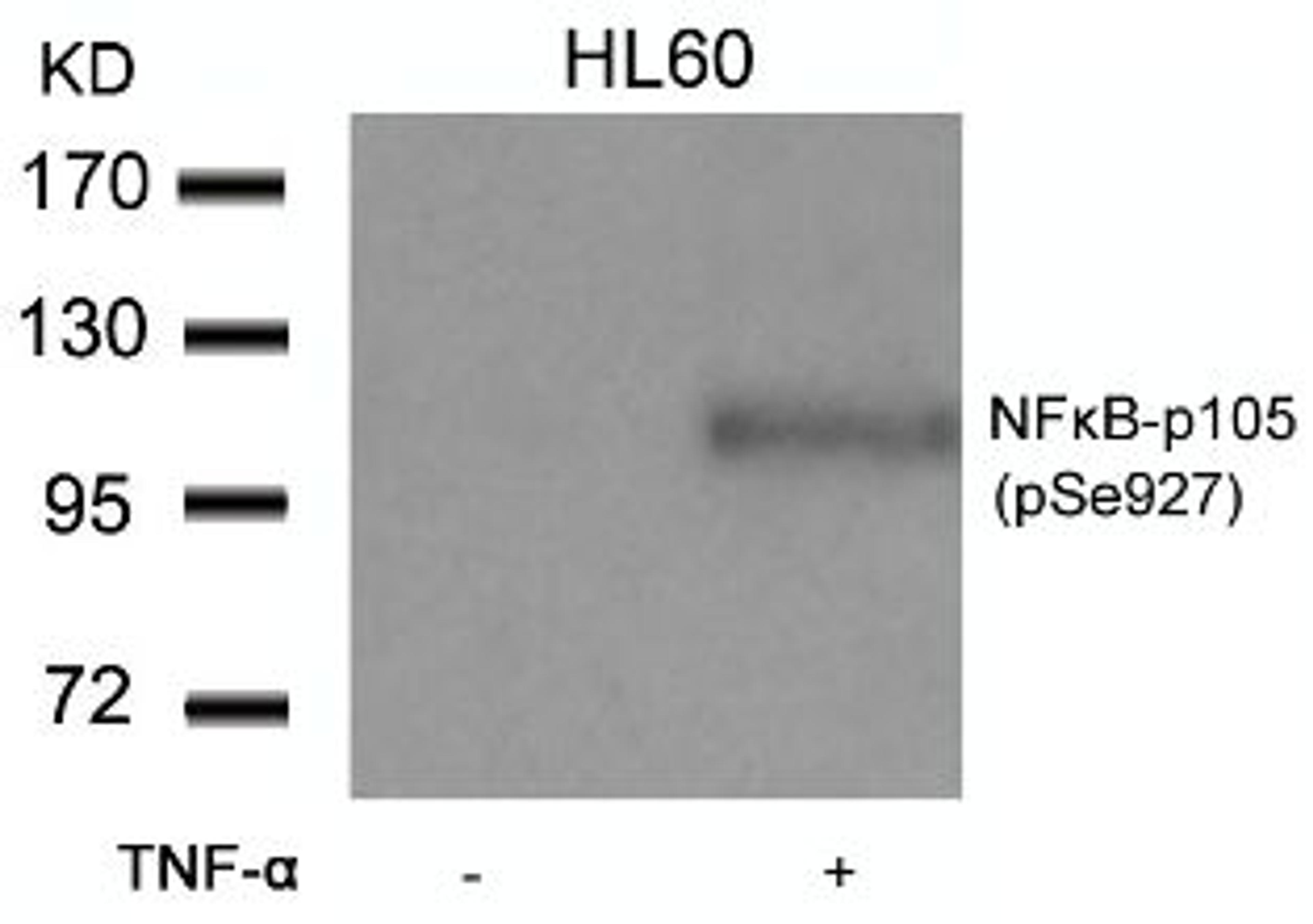 Western blot analysis of lysed extracts from HL60 cells untreated or treated with TNF-&#945; using NF&#954;B-p105/p50 (Phospho-Ser927).