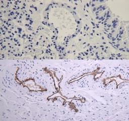 Immunohistochemistry-Paraffin: CD31/PECAM-1 Antibody (JC/70A) [NB600-562] - Analysis using the Biotin conjugate of NB600-562. Comparison between mouse (lung, top) and human (prostate, bottom) staining using anti-CD31 antibody. Data demonstrates that the antibody stains human, but not mouse CD31. Image from verified customer revie