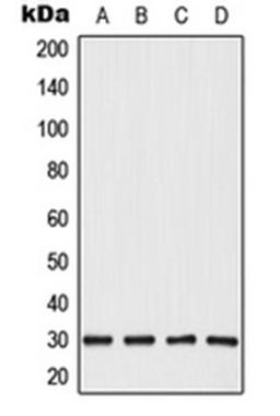 Western blot analysis of HepG2 (Lane 1), HeLa (Lane 2), SP2/0 (Lane 3), PC12 (Lane 4) whole cell lysates using CABYR antibody