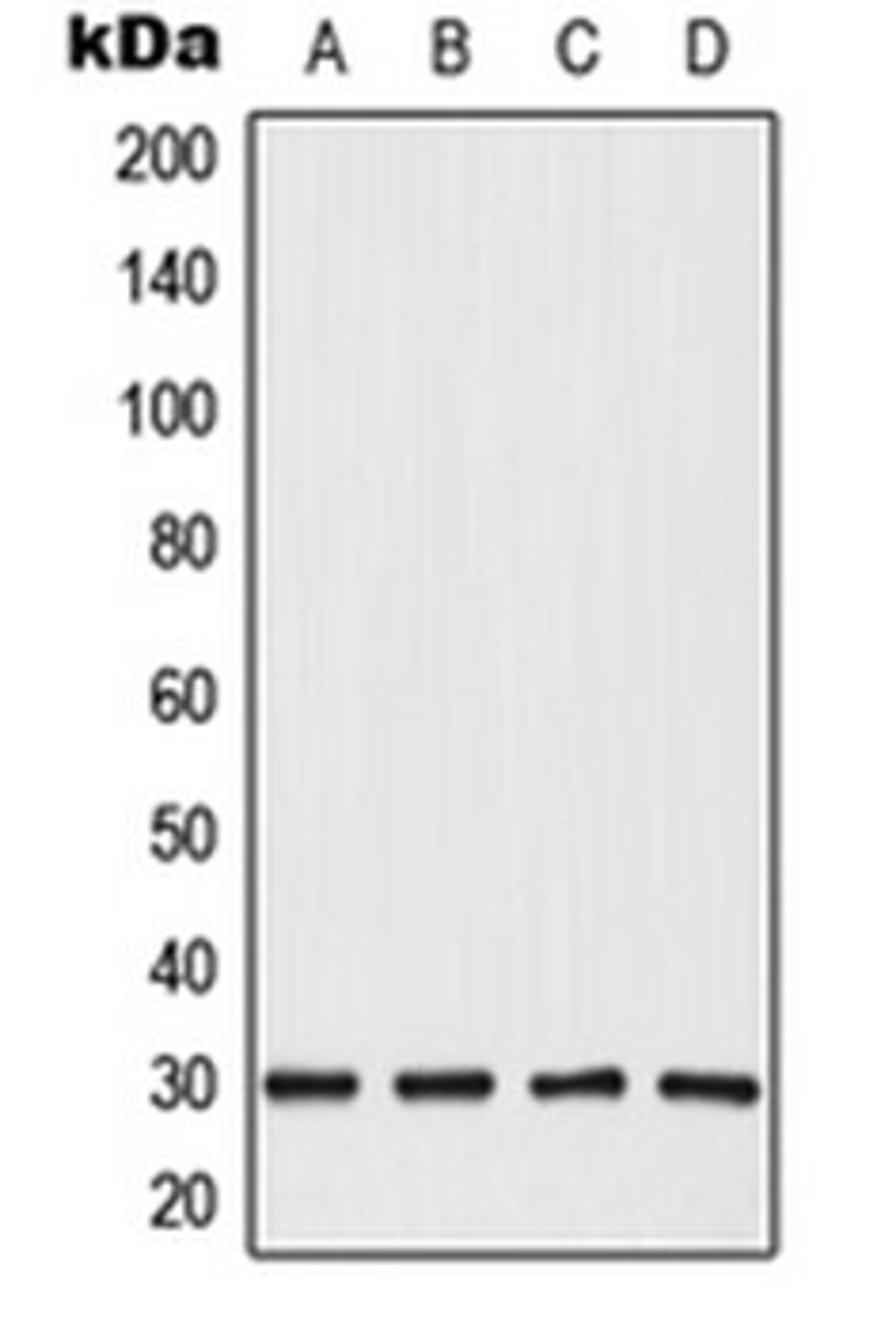 Western blot analysis of HepG2 (Lane 1), HeLa (Lane 2), SP2/0 (Lane 3), PC12 (Lane 4) whole cell lysates using CABYR antibody