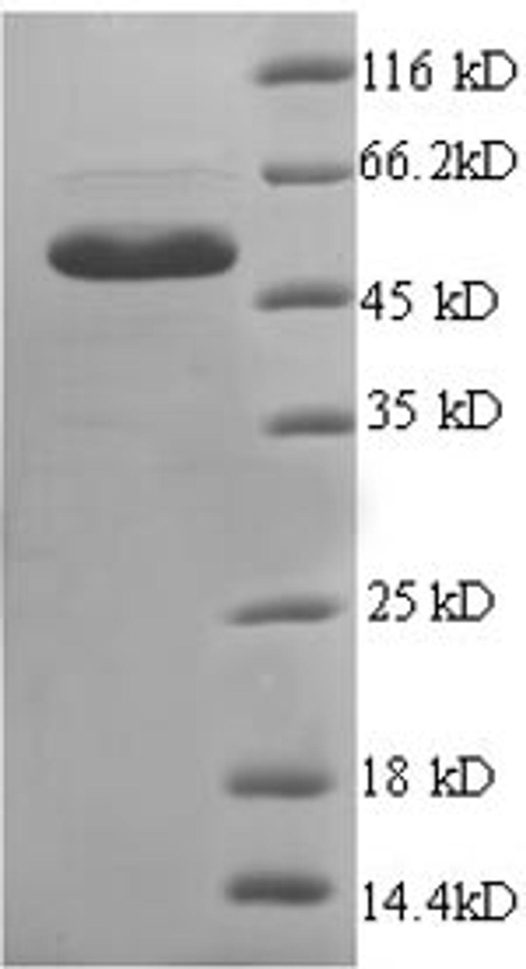 (Tris-Glycine gel) Discontinuous SDS-PAGE (reduced) with 5% enrichment gel and 15% separation gel.