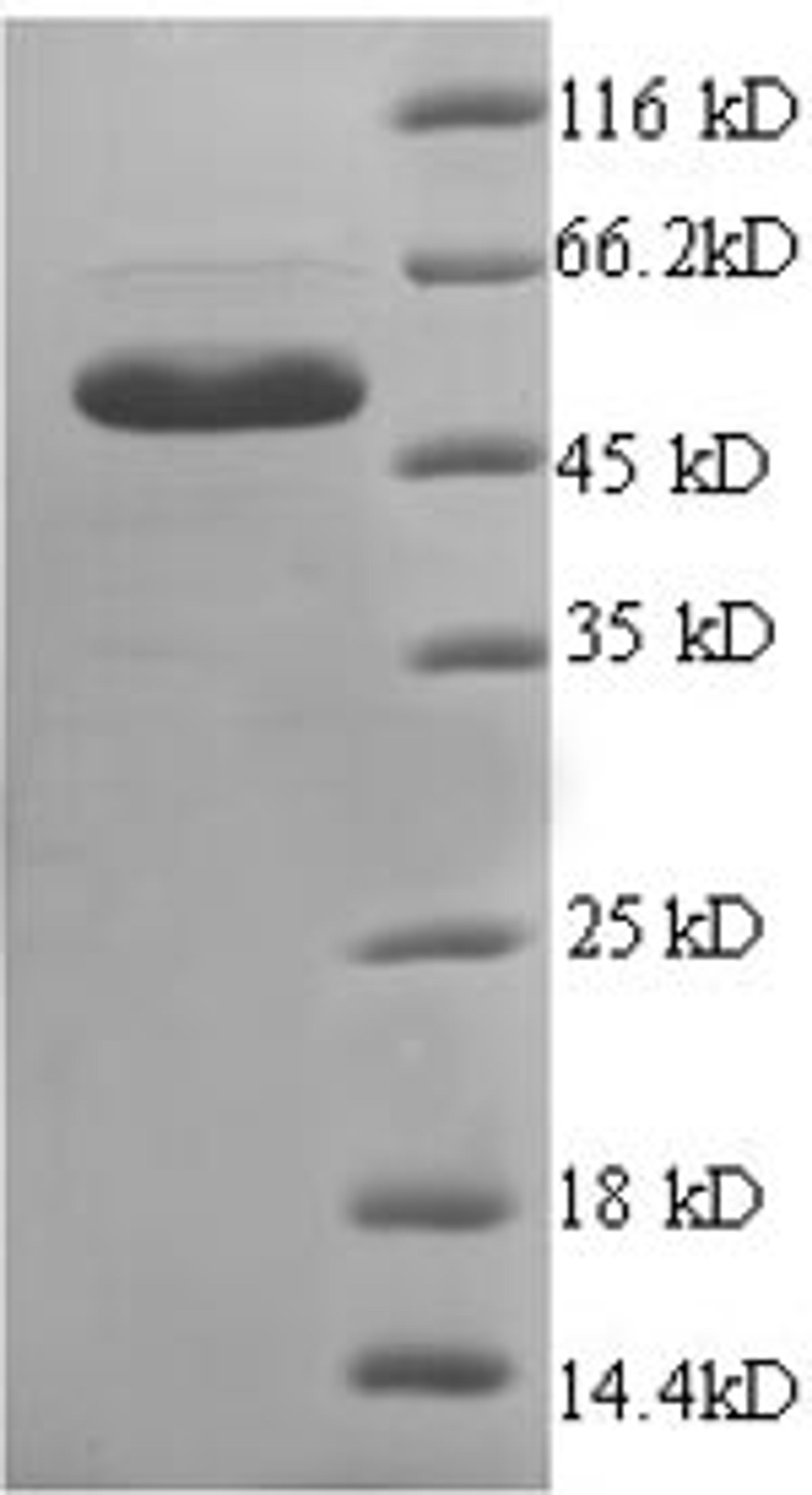 (Tris-Glycine gel) Discontinuous SDS-PAGE (reduced) with 5% enrichment gel and 15% separation gel.
