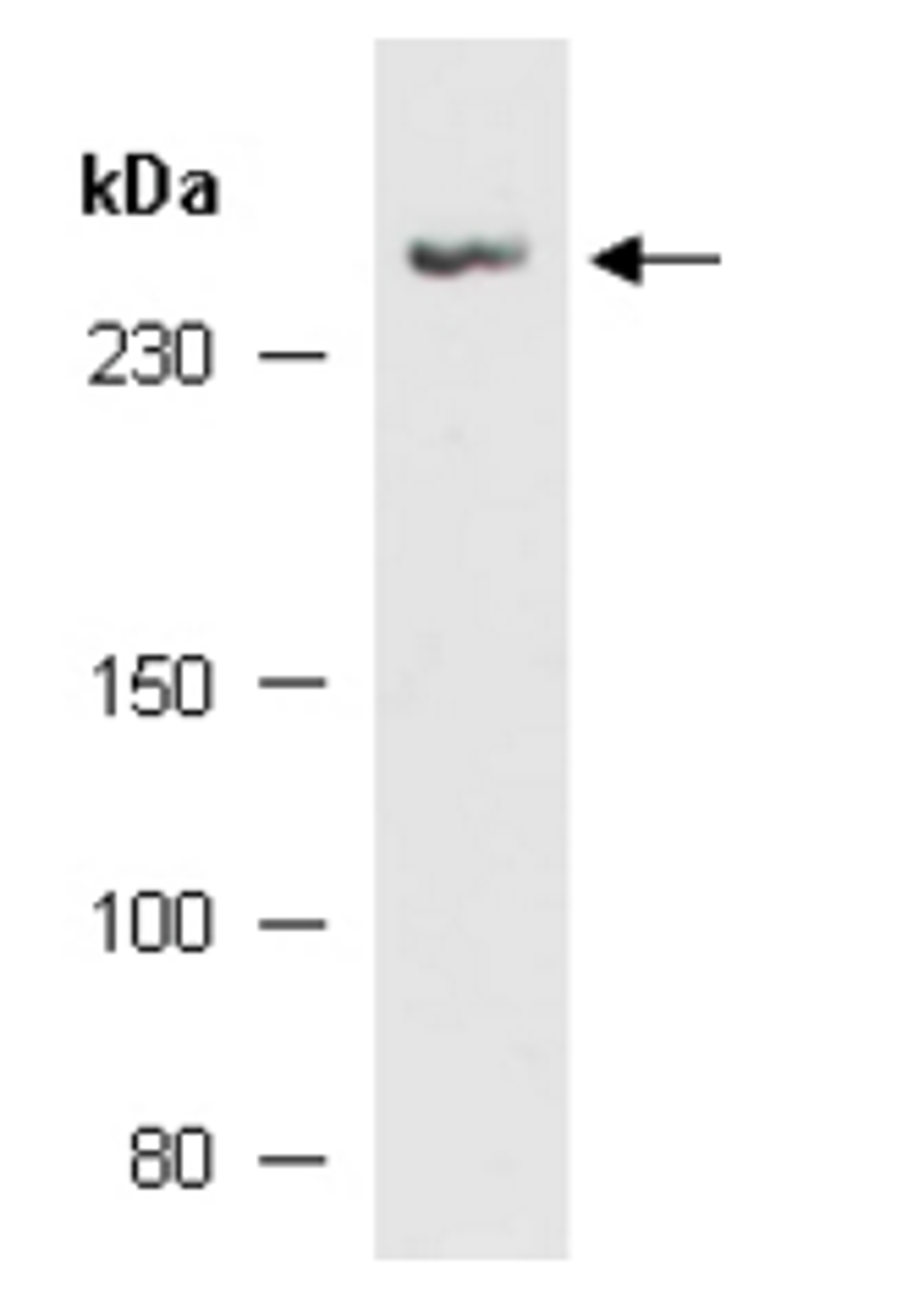 Western blot analysis of mouse brain using NCKAP5 antibody