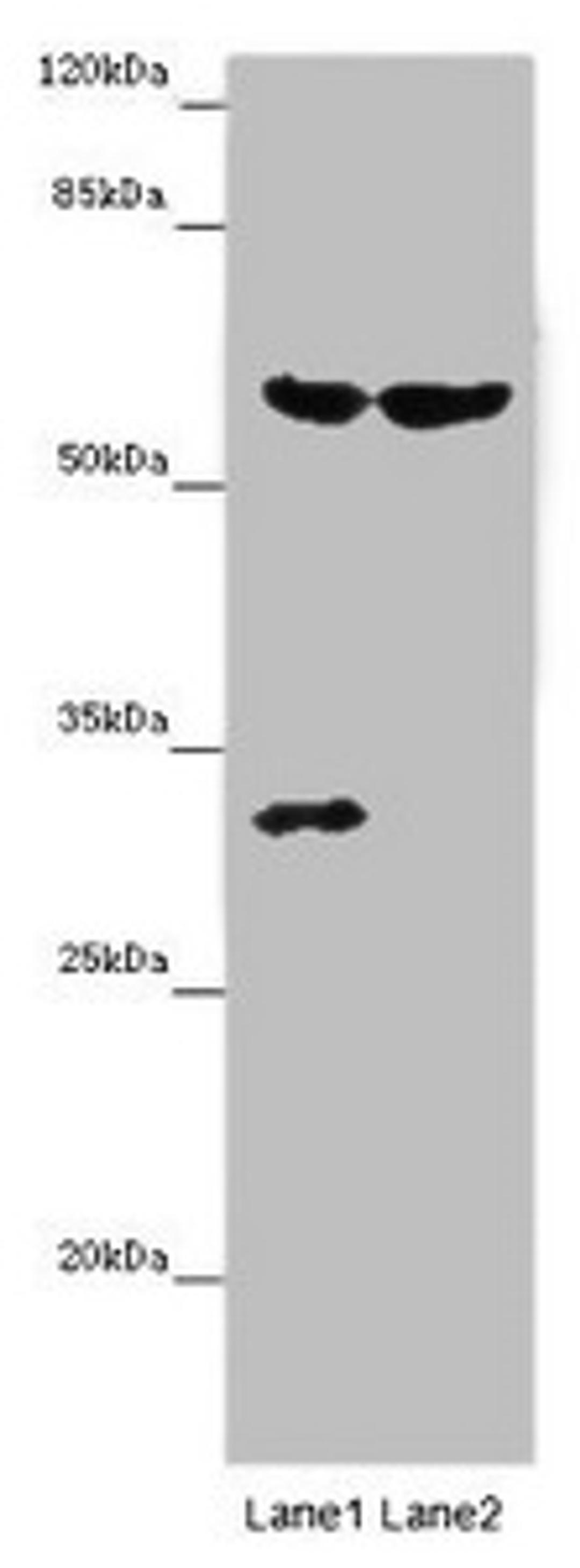 Western blot. All lanes: TERF2 antibody at 14 ug/ml. Lane 1: Mouse thymus tissue. Lane 2: MCF-7 whole cell lysate. Secondary. Goat polyclonal to rabbit IgG at 1/10000 dilution. Predicted band size: 60, 33 kDa. Observed band size: 60, 31 kDa.