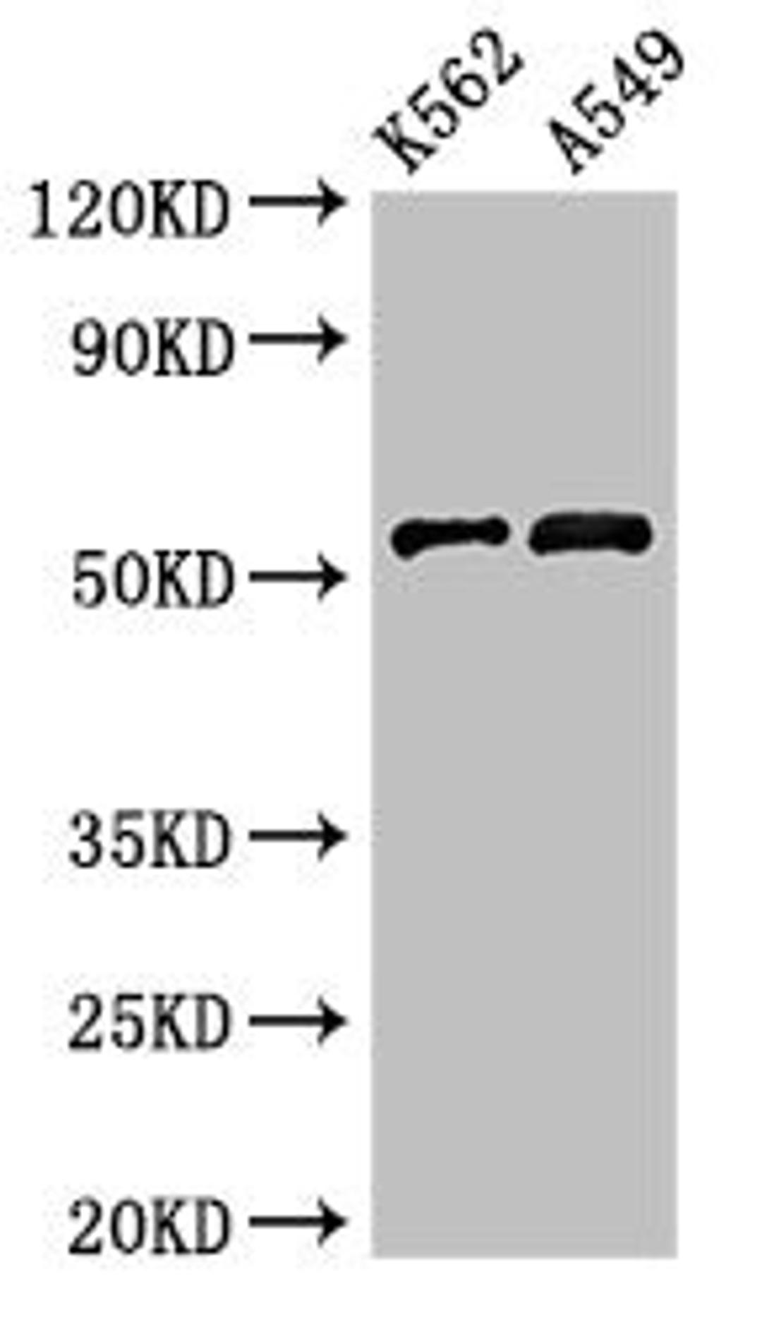 Western Blot. Positive WB detected in: K562 whole cell lysate, A549 whole cell lysate. All lanes: CELF2 antibody at 3µg/ml. Secondary. Goat polyclonal to rabbit IgG at 1/50000 dilution. Predicted band size: 55, 53, 56 kDa. Observed band size: 55 kDa