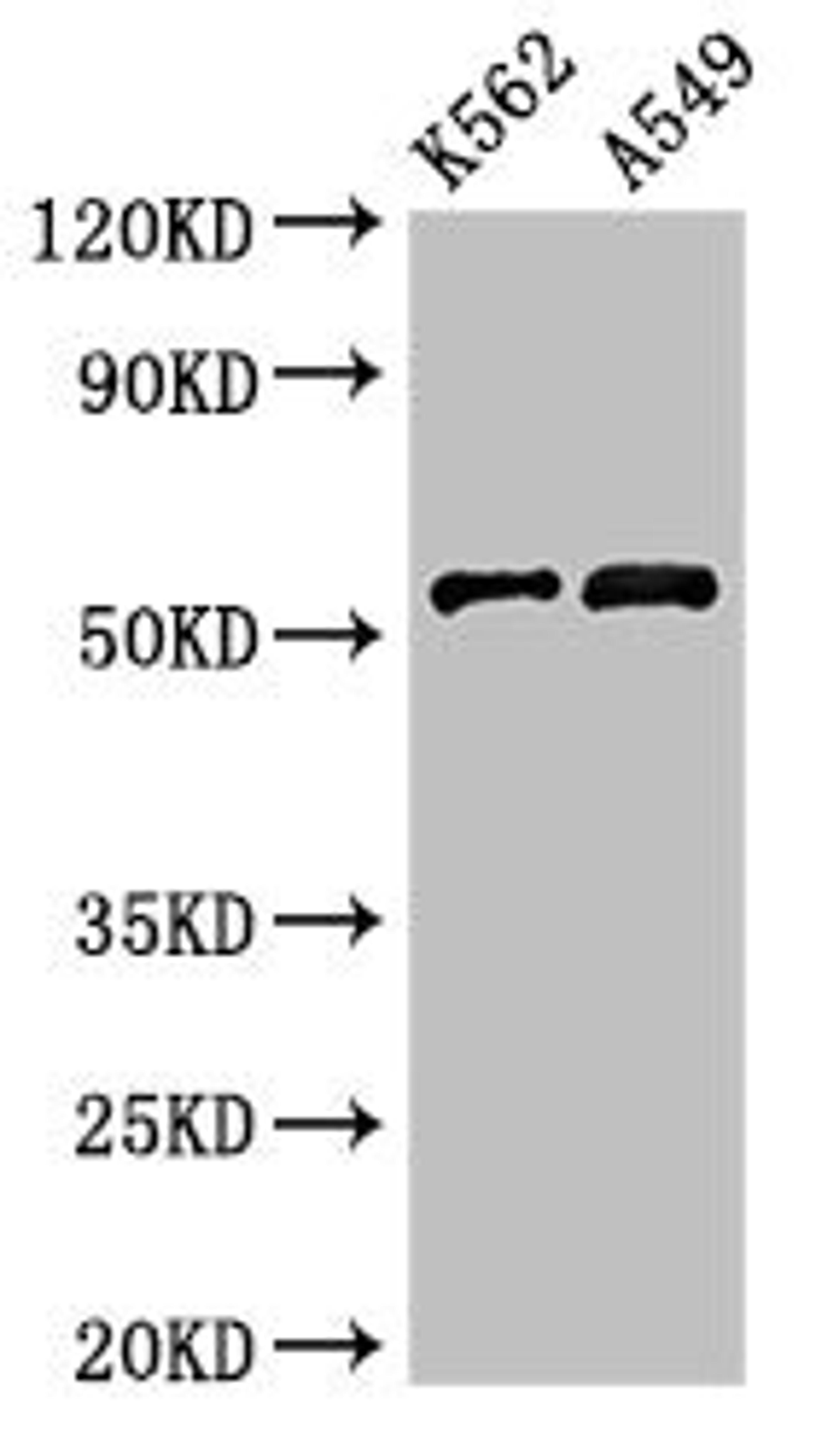 Western Blot. Positive WB detected in: K562 whole cell lysate, A549 whole cell lysate. All lanes: CELF2 antibody at 3µg/ml. Secondary. Goat polyclonal to rabbit IgG at 1/50000 dilution. Predicted band size: 55, 53, 56 kDa. Observed band size: 55 kDa