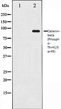 Western blot analysis of SW626 whole cell lysates using Catenin- beta (Phospho-Thr41/Ser45) antibody, The lane on the left is treated with the antigen-specific peptide.