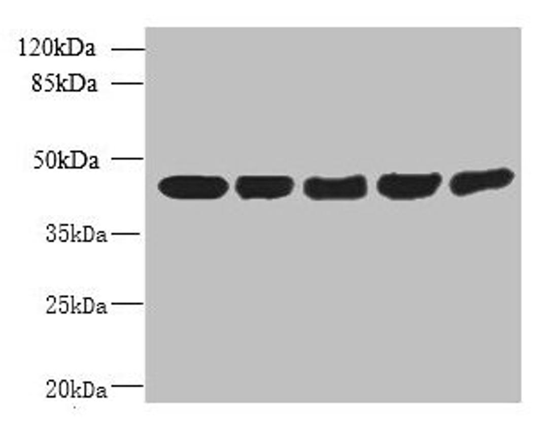 Western blot. All lanes: ACTRT3 antibody at 2.5ug/ml. Lane 1: MCF-7 whole cell lysate. Lane 2: HCT116 whole cell lysate. Lane 3: K562 whole cell lysate. Lane 4: 293T whole cell lysate. Lane 5: Hela whole cell lysate. Secondary. Goat polyclonal to rabbit IgG at 1/10000 dilution. Predicted band size: 42 kDa. Observed band size: 42 kDa.