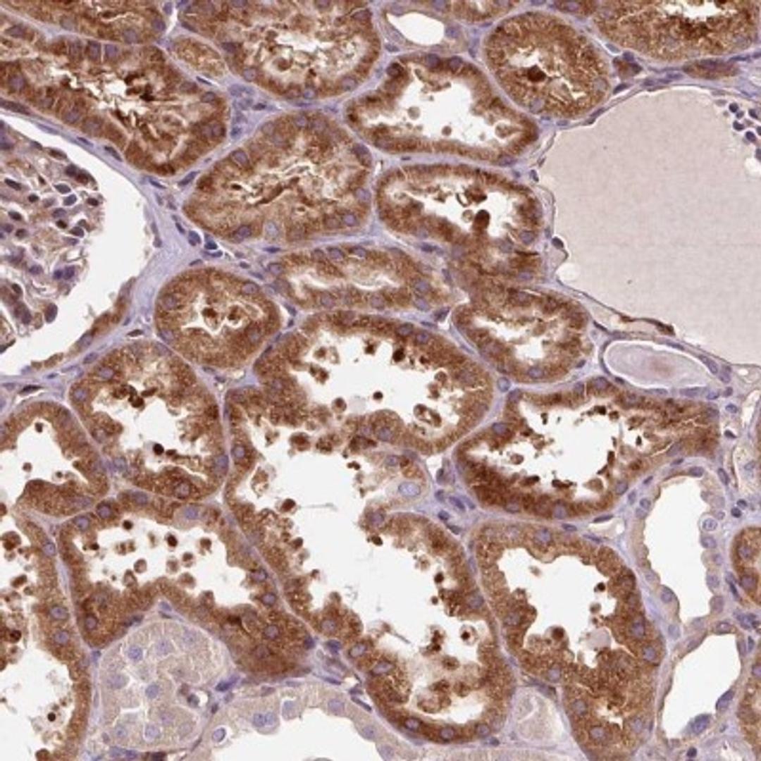 Immunohistochemistry: PCDHGB3 Antibody [NBP2-32022] - Staining of human kidney shows strong cytoplasmic positivity in cells in tubules.