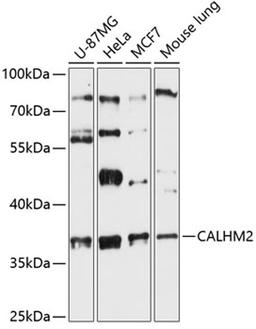 Western blot - CALHM2 antibody (A13006)