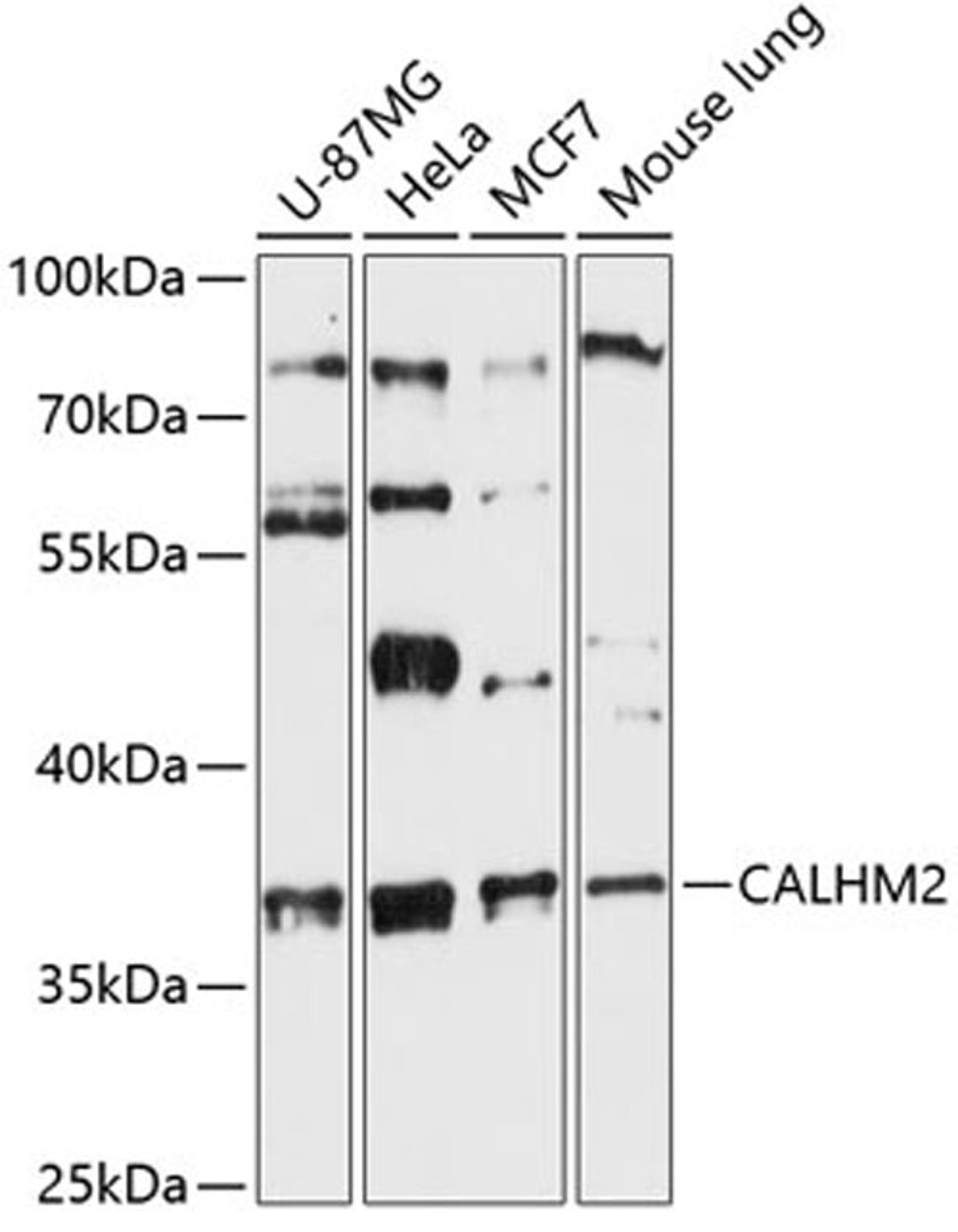 Western blot - CALHM2 antibody (A13006)