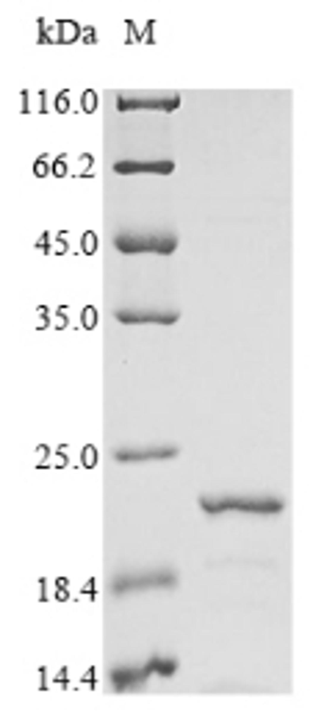 (Tris-Glycine gel) Discontinuous SDS-PAGE (reduced) with 5% enrichment gel and 15% separation gel.