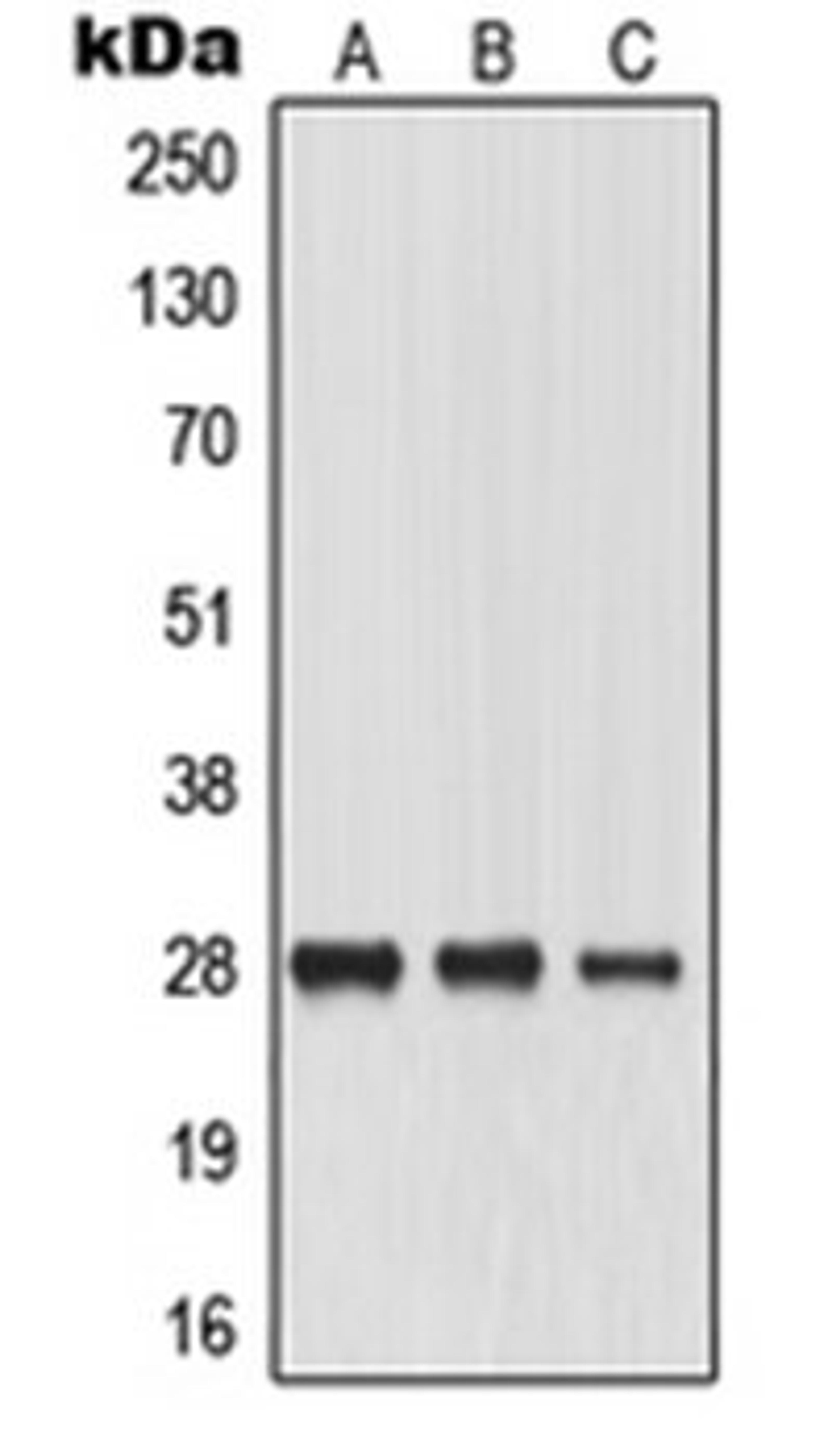 Western blot analysis of HeLa (Lane 1), SP2/0 (Lane 2), PC12 (Lane 3) whole cell lysates using MIP antibody