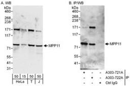 Detection of human MPP11 by western blot and immunoprecipitation.