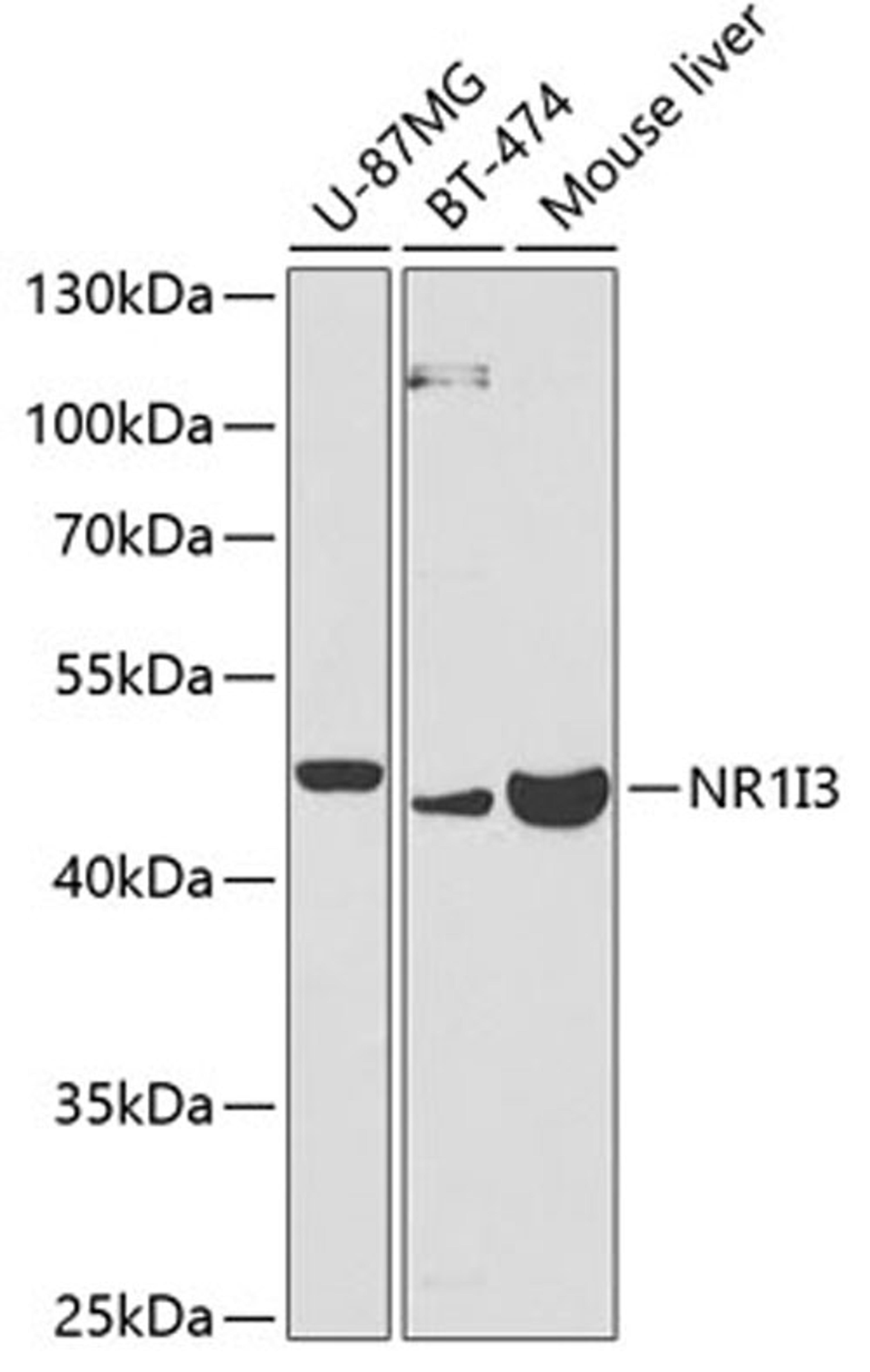 Western blot - NR1I3 antibody (A1970)