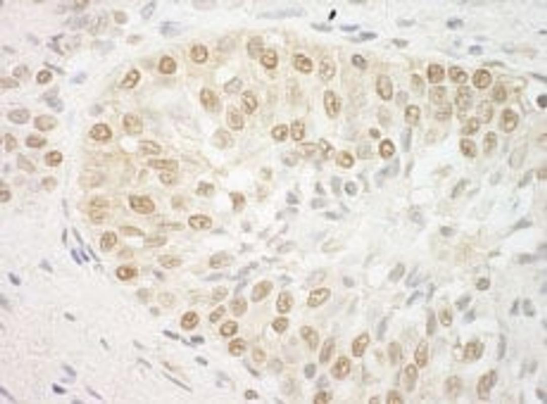 Detection of human ARID3B by immunohistochemistry.