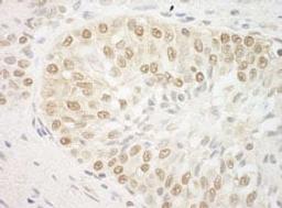 Detection of human ARID3B by immunohistochemistry.